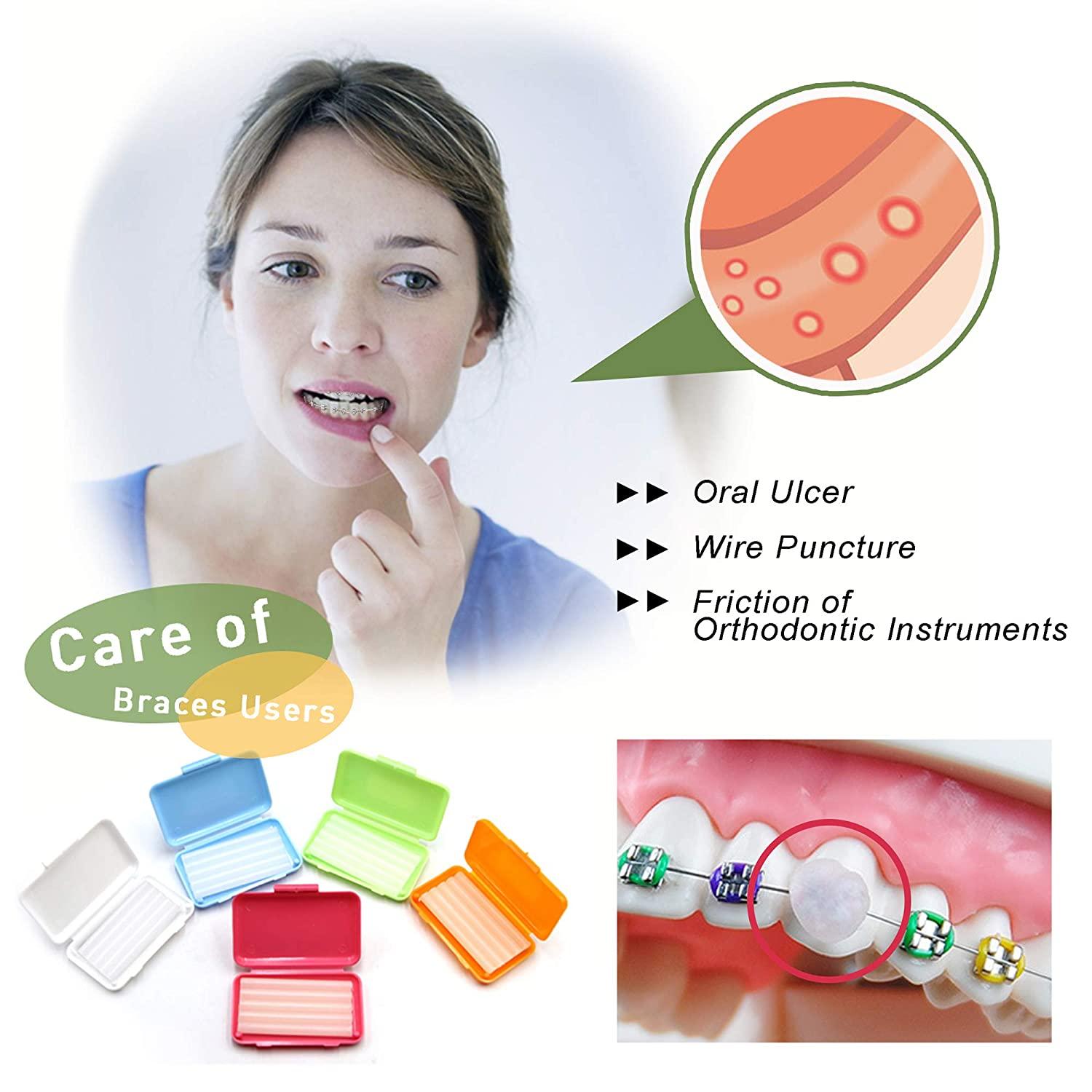 BRMDT Braces Wax, Dental Wax for Braces Moldable Orthodontic Wax for Retainer/Brace Wearers