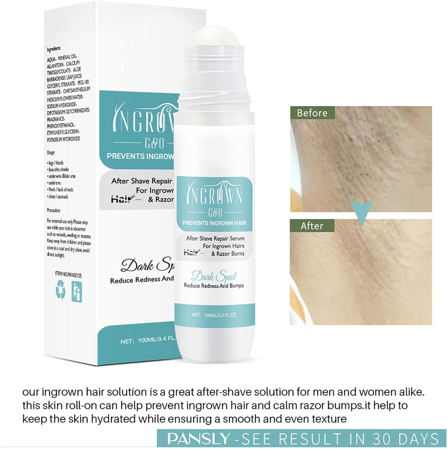 100ml After Trimming Serum for Ingrown Hair | Tend Skin Solution for