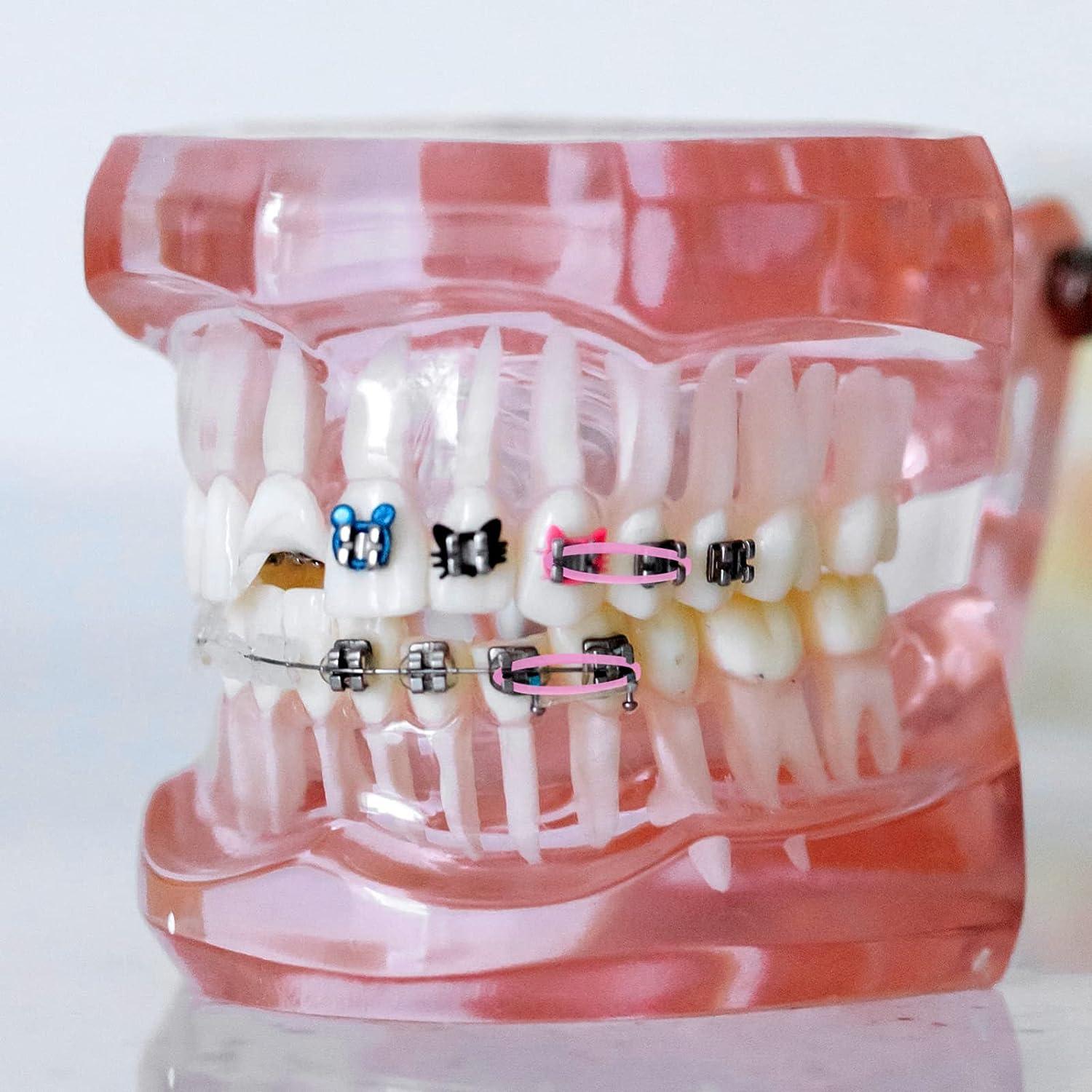 Operitacx Thread Spool Holder Orthodontic Braces Rubber Chains Dental