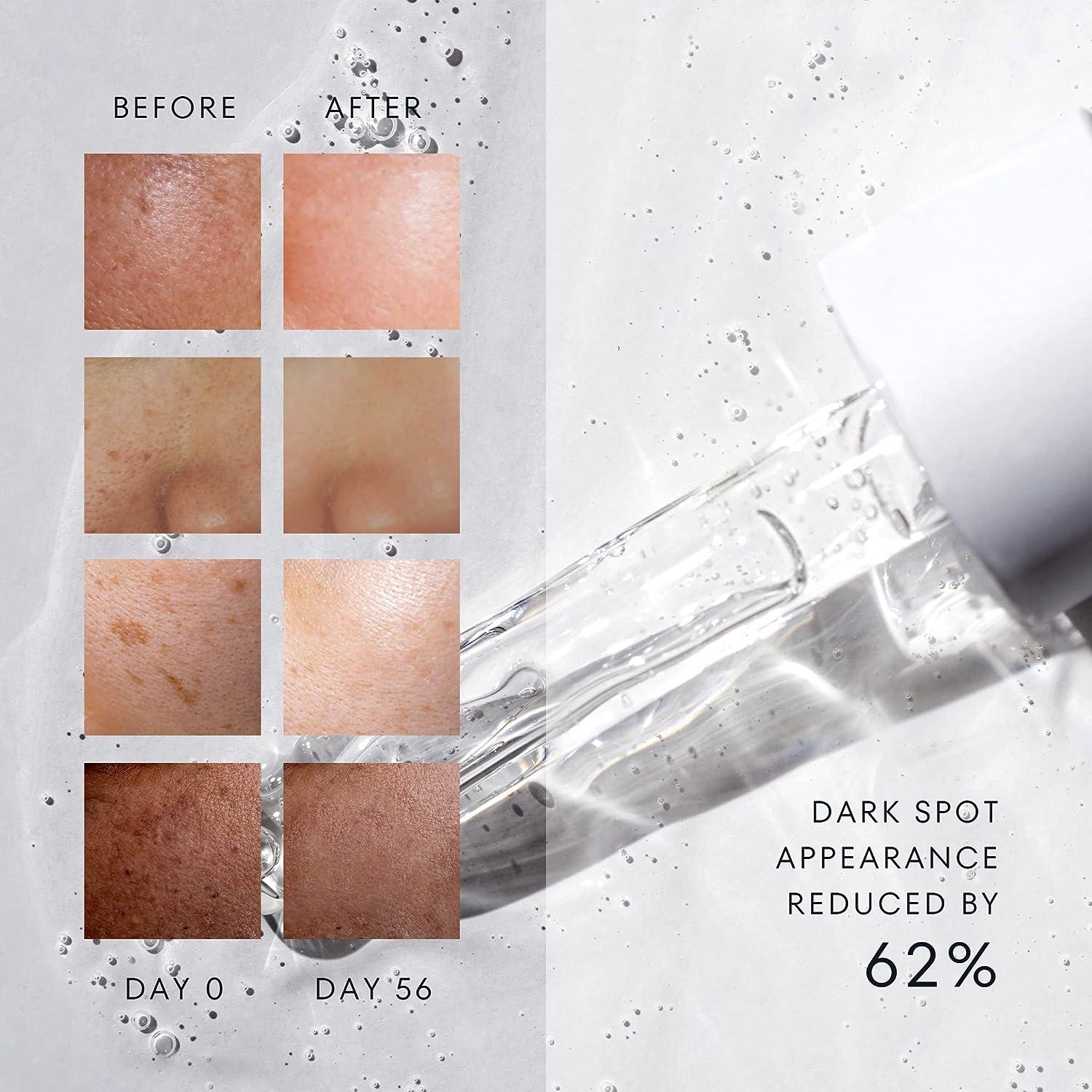 Dark Spot Remover Serum with Niacinamide & Tranexamic Acid for