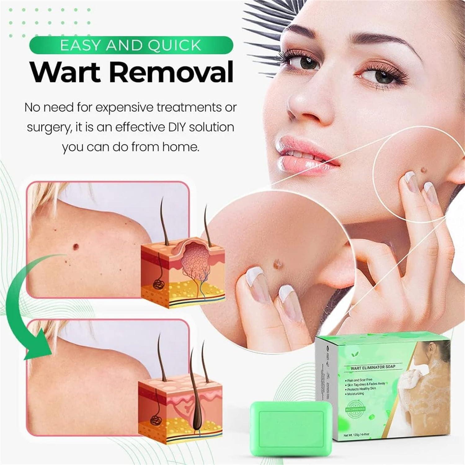 Genryu Aloe Vera Wart Eliminator Soap 100g (2 PC) - Sulfate Free, Ultra  Moisturising | Buy Now with Express International Delivery | GoSupps.com