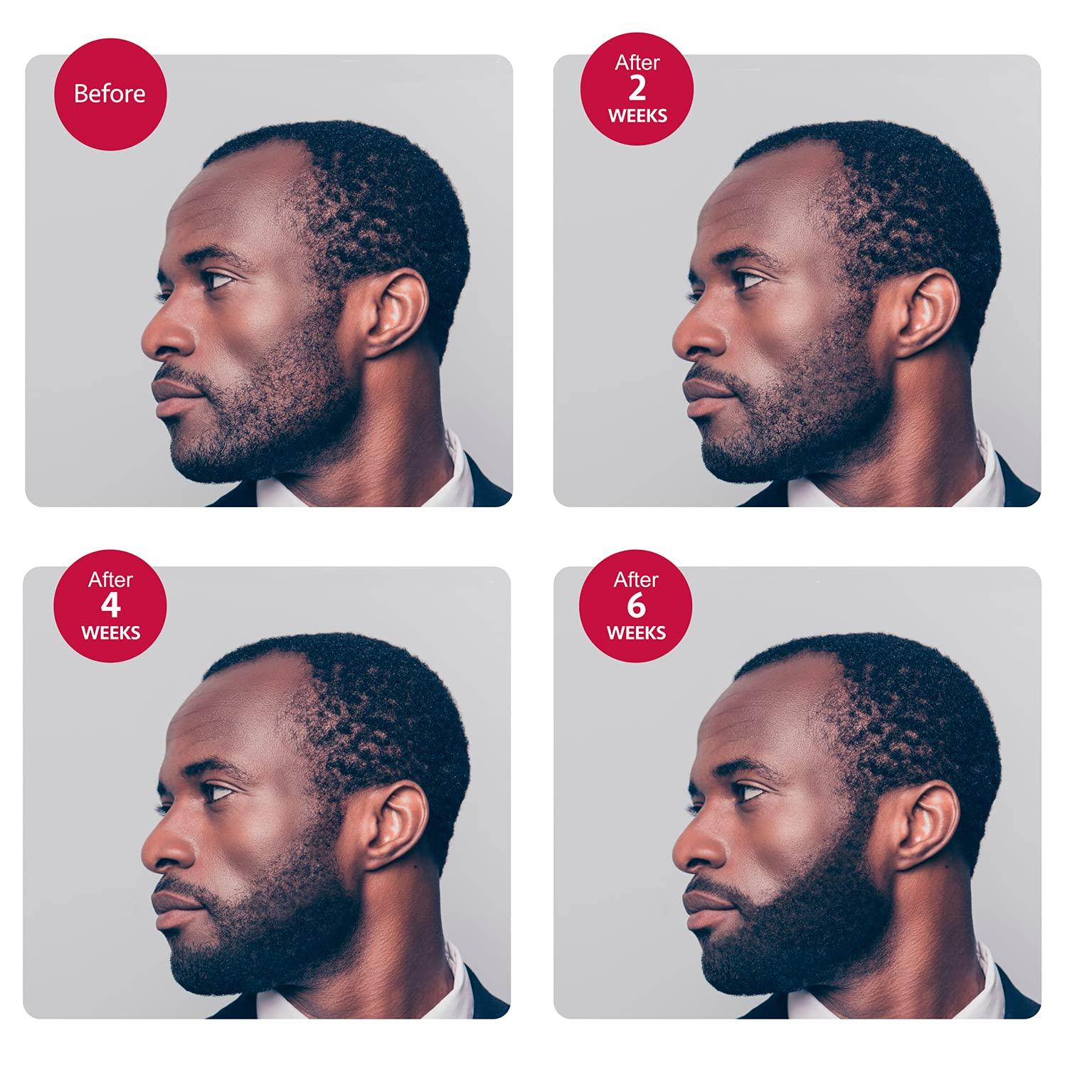 Godefroy Thick Beard and Mustache Growth Serum for Ethnic Hair Types