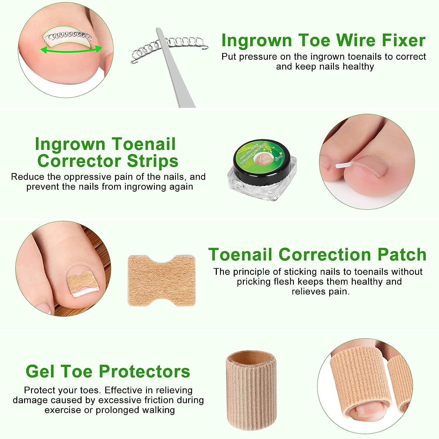 Ingrown Toenail Removal Kit 11 Pcs Ingrown Toenail Pain Treatment