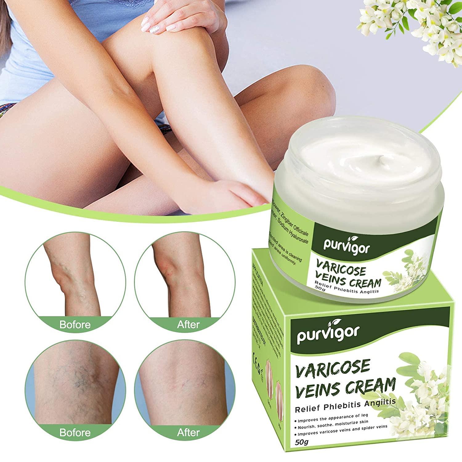Varicose Veins Cooling Cream 1.8 oz Reduce Swelling & Improve
