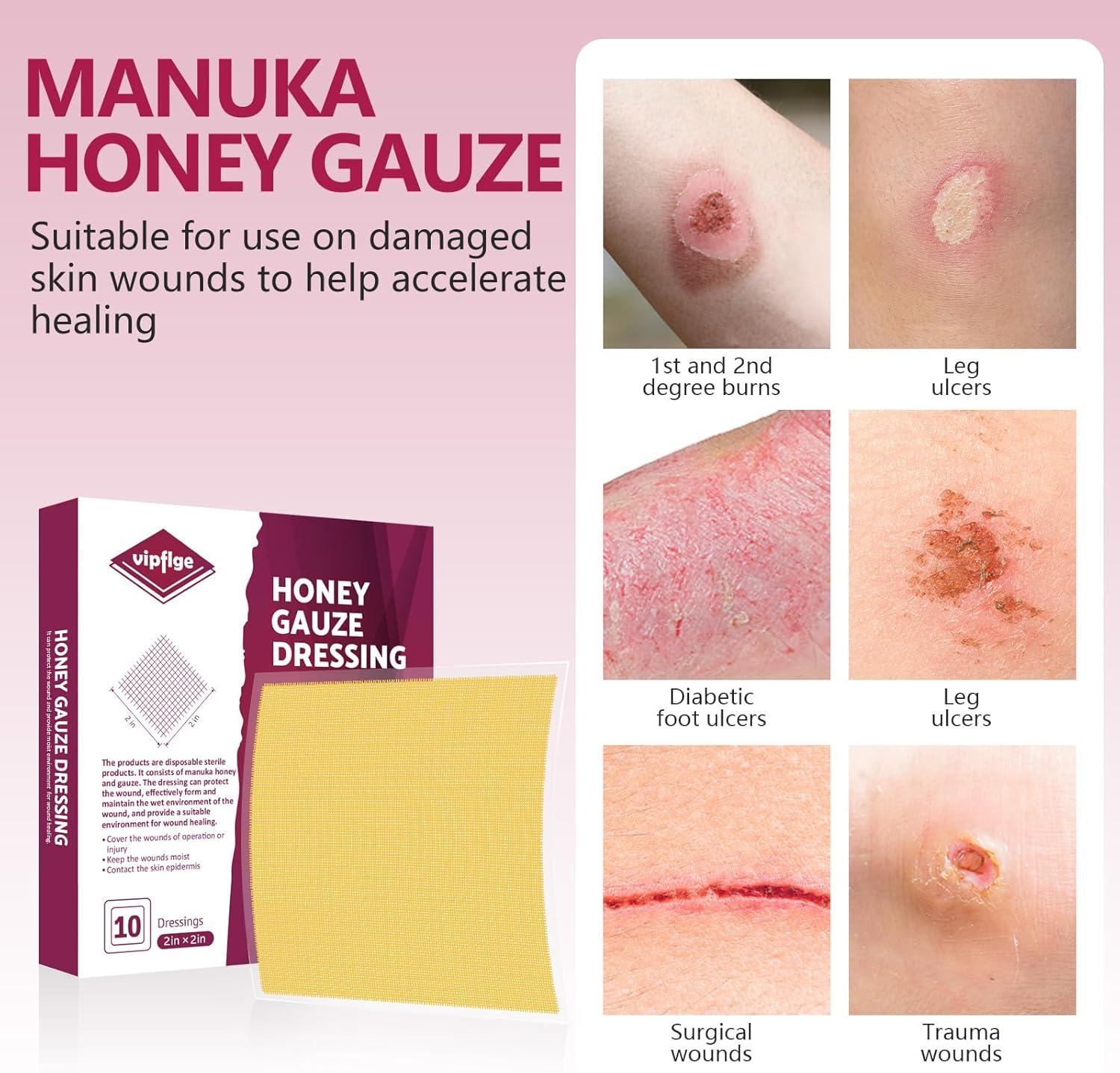 Manuka Honey Gauze Dressing 2x2 | Medical Grade Honey Patches for Wound Care | Pack of 10 for Faster Healing | Buy Now with Express International Delivery | GoSupps.com Manuka Honey Gauze Dressing 2x2 | Medical Grade Honey Patches for Wound Care | Pack of 10 for Faster Healing | Buy Now with Express International Delivery | GoSupps.com