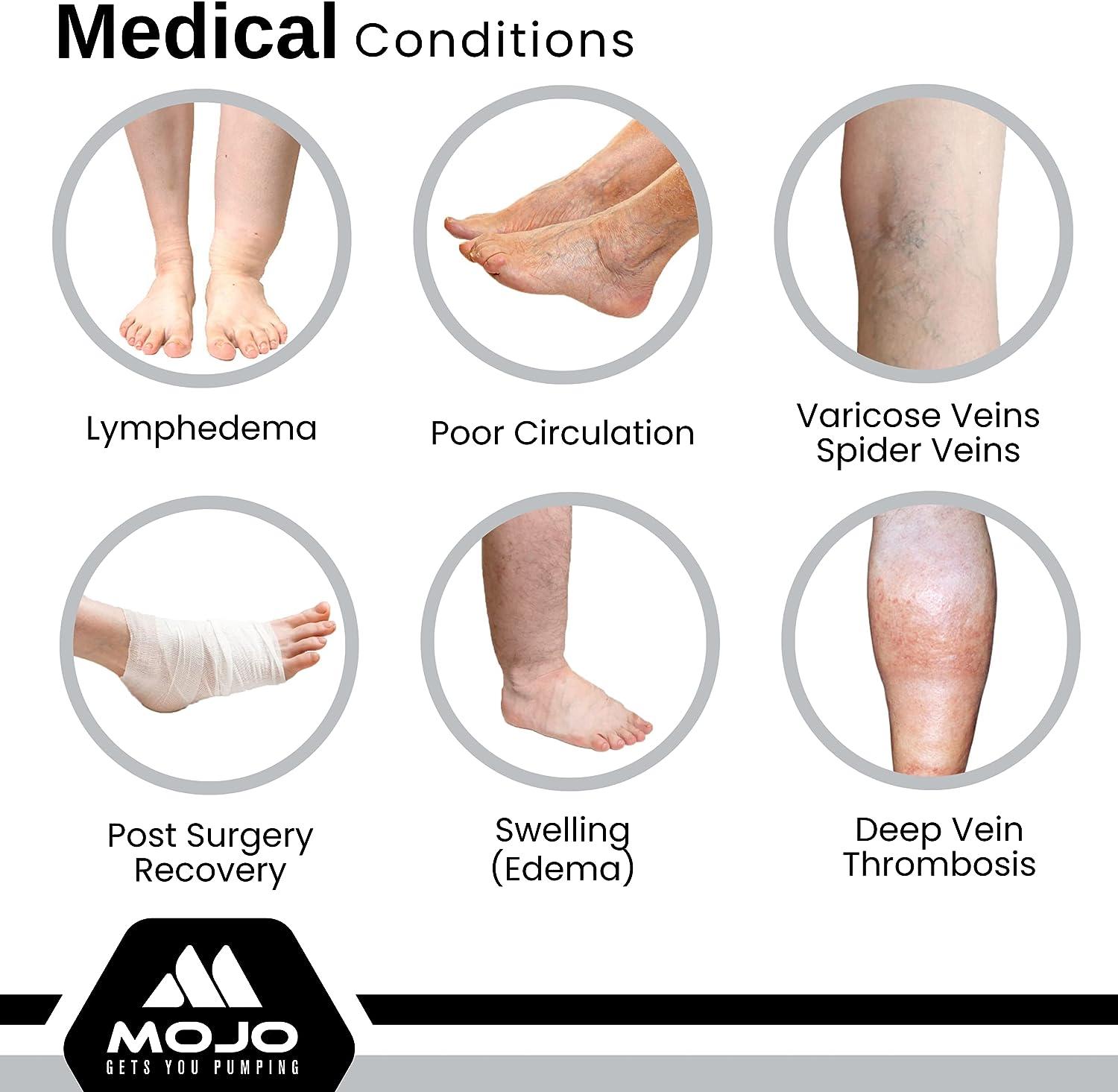 Mojo Compression Socks Women's ThighHigh Leg Sleeves for Chronic