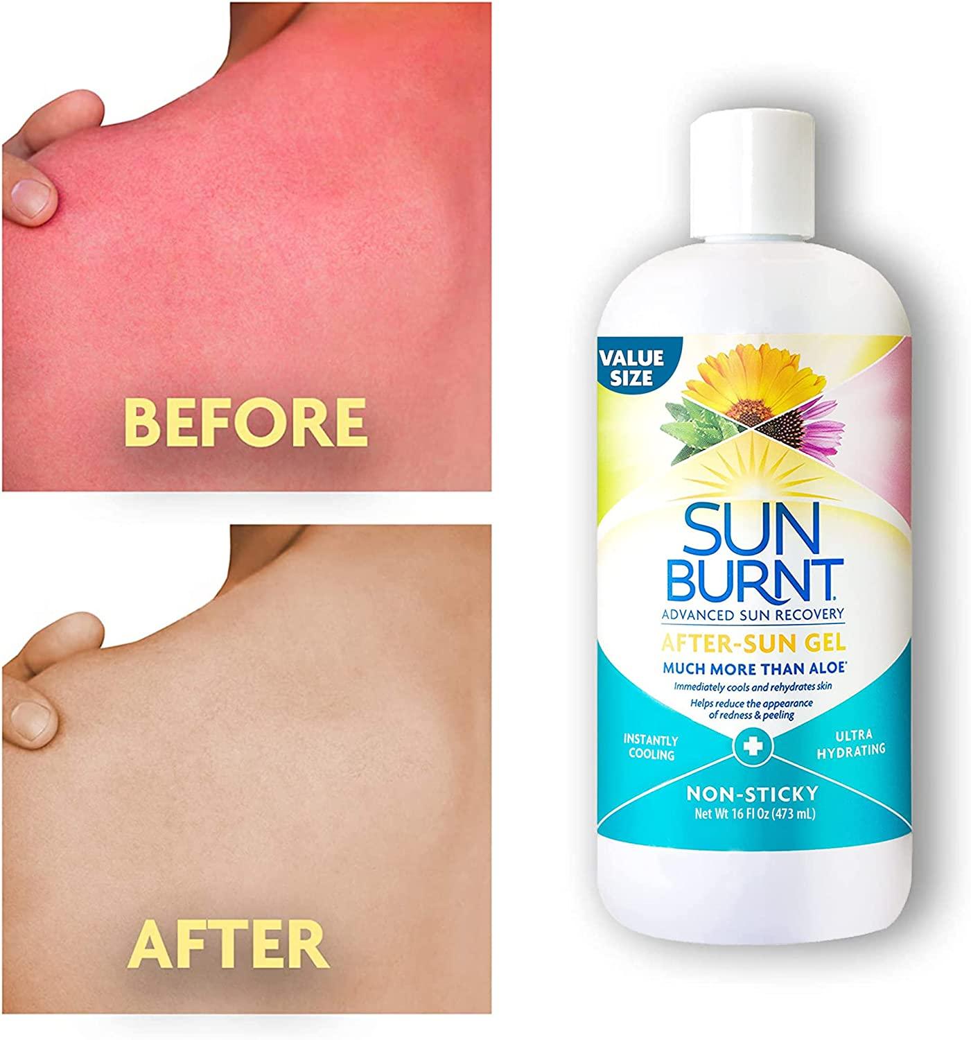 Sunburnt Ultra Hydrating Aloe Vera Gel by with Natural Organic Aloe