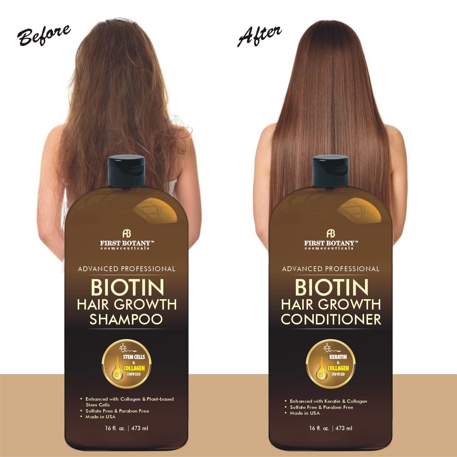 Biotin Hair Growth Shampoo Conditioner - An Anti Hair Loss Set Thickening  formula, Collagen & Stem Cell For Hair Regrowth, Anti Thinning Sulfate Free  For Men & Women Anti Dandruff Treatment 16