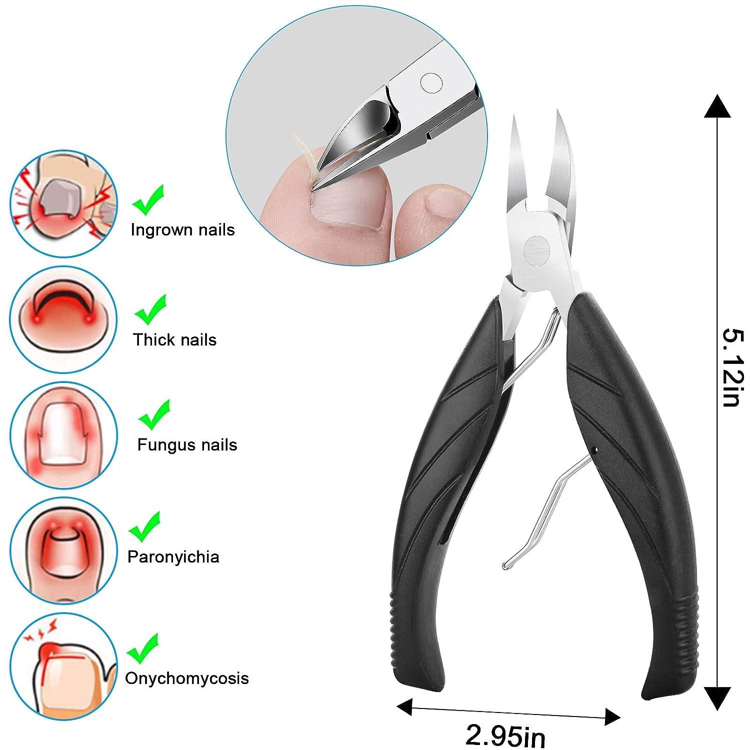 Ingrown Toenail Removal Kit Ingrown Nails Treatment with Toenails
