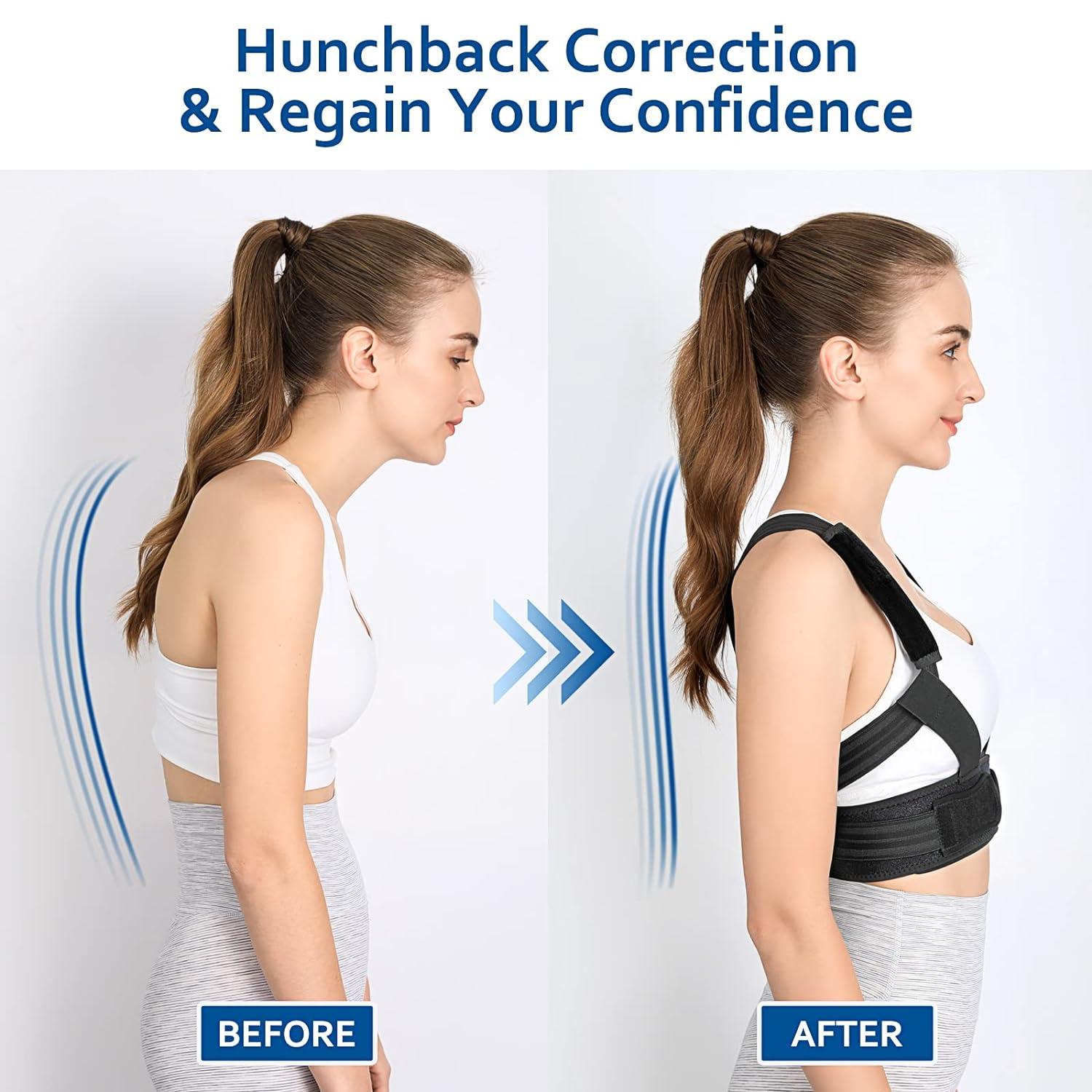 Mercase Posture Corrector for Women and Men Back Support Brace for Posture  Shoulder Kyphosis Scoliosis Rounded Shoulder Corrector Fully Adjustable and  Breathable (Large)