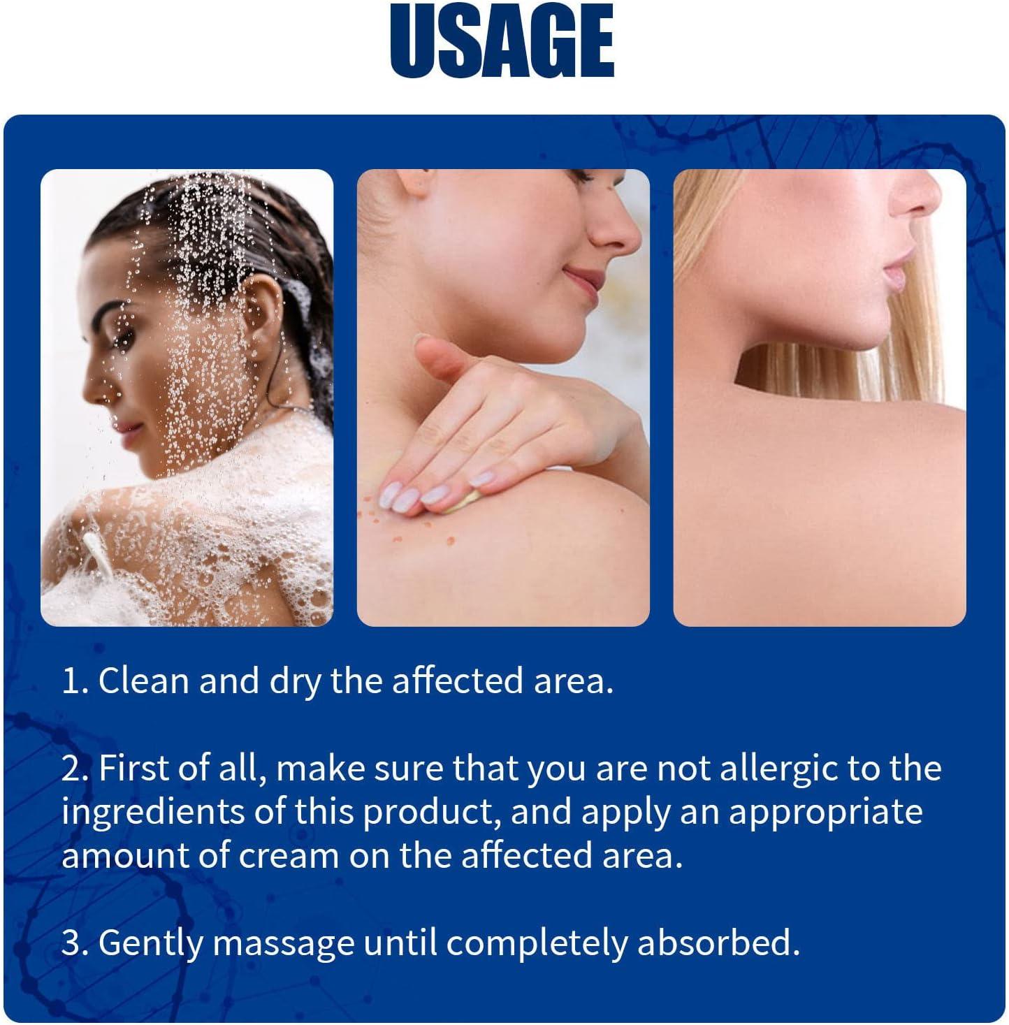 Qinlorgo Skin Psoriasis Paste Cream 2pcs - 20g Herbal Cream for Tinea ...