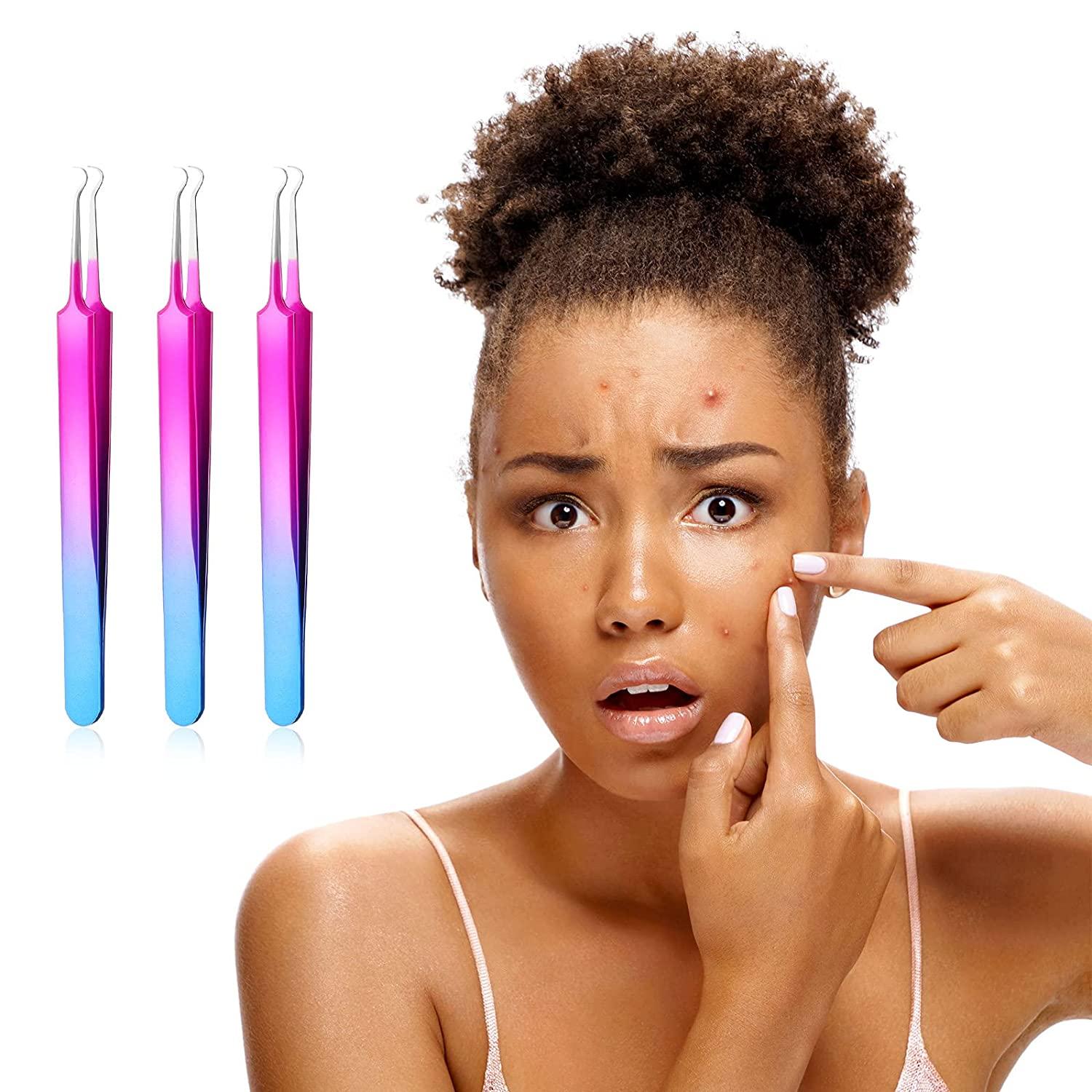 3 Pieces Blackhead Tweezers Blemish Stainless Steel Blemish Extractor