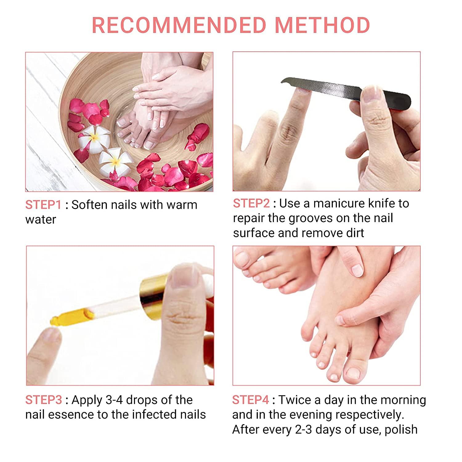 LANBENA Nail Repair Essence Nail Repair Treatment for Damaged Nails