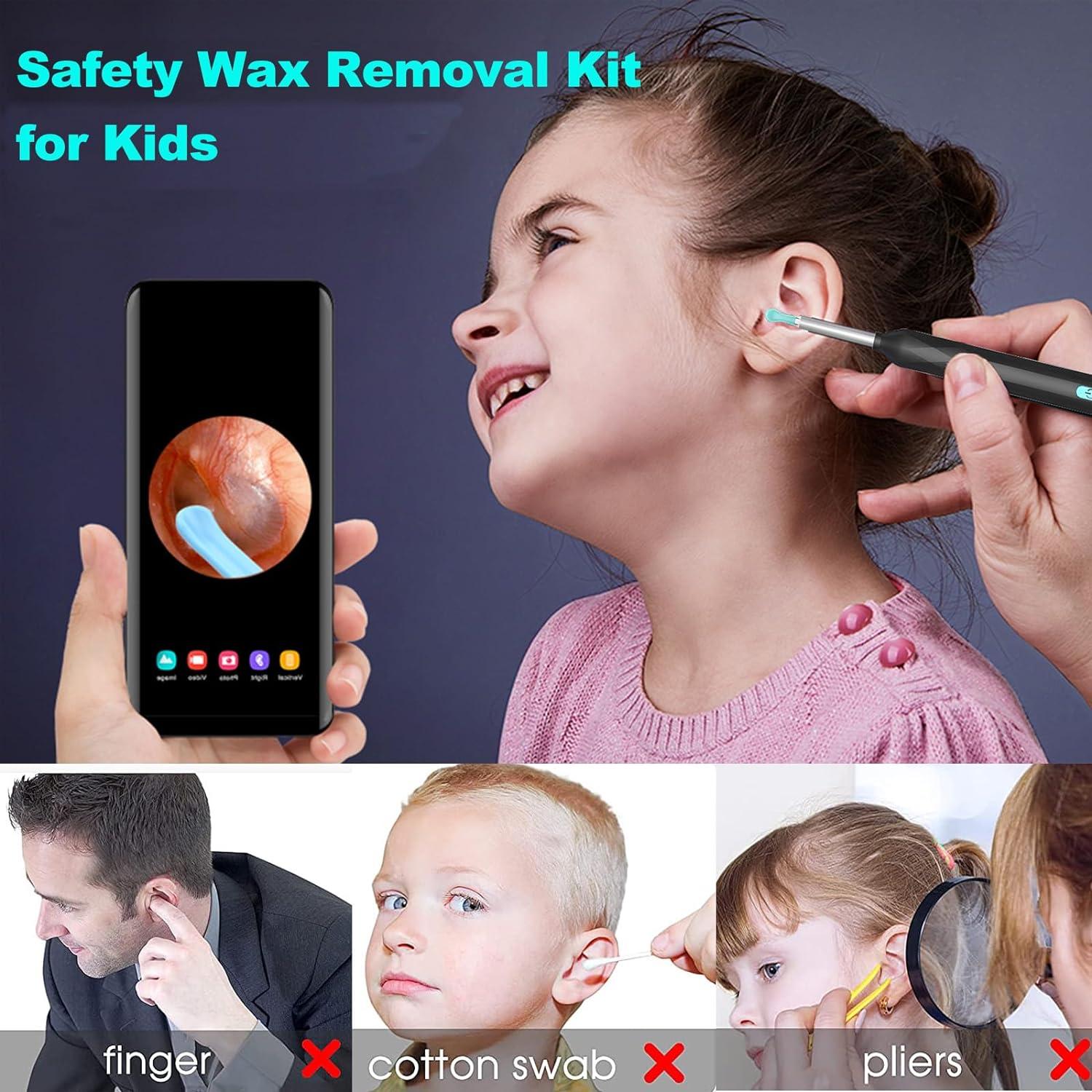 Fenxyo Wireless Ear Wax Removal Kit with Camera 8 Million Pixel HD