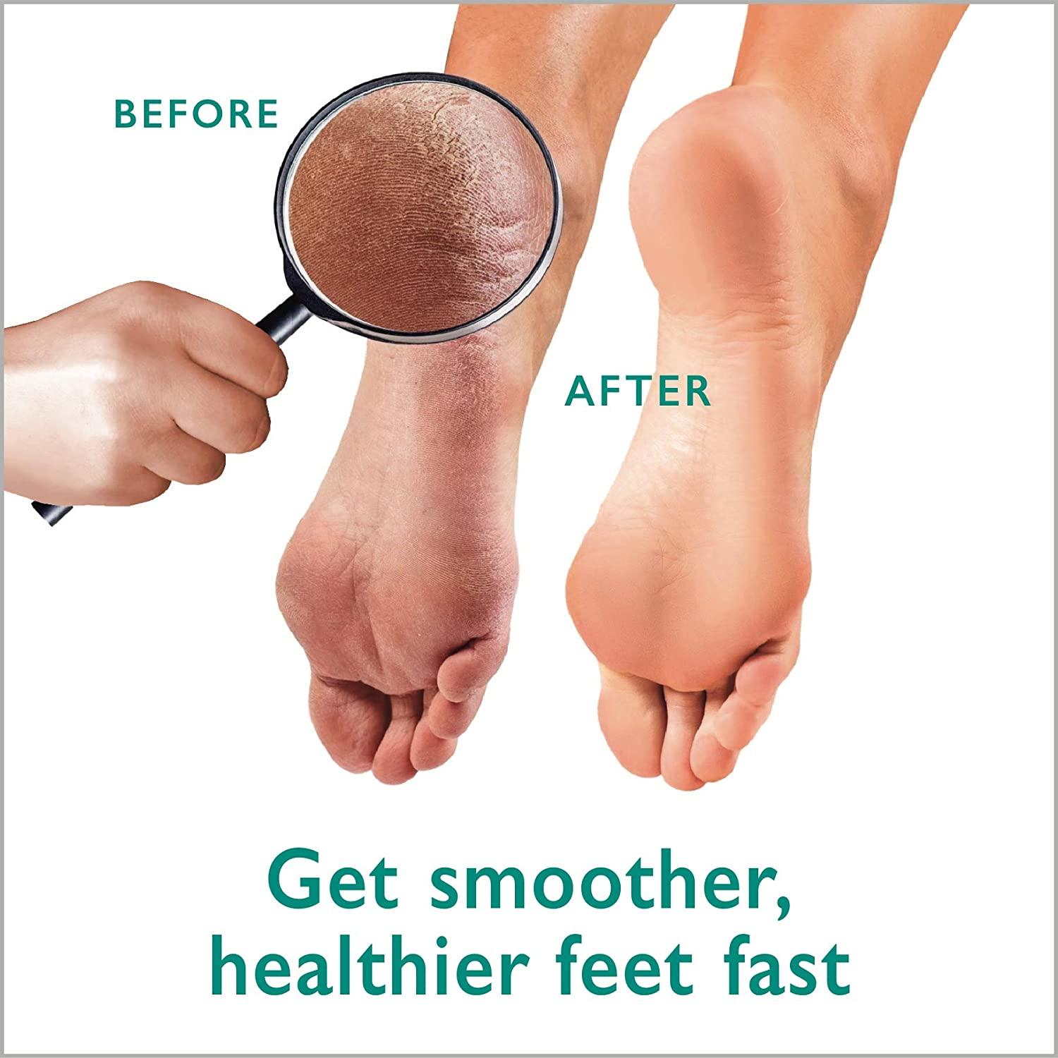 Callus Remover Gel & Foot Scrubber Kit â€“ Ultimate Pedicure Tools for