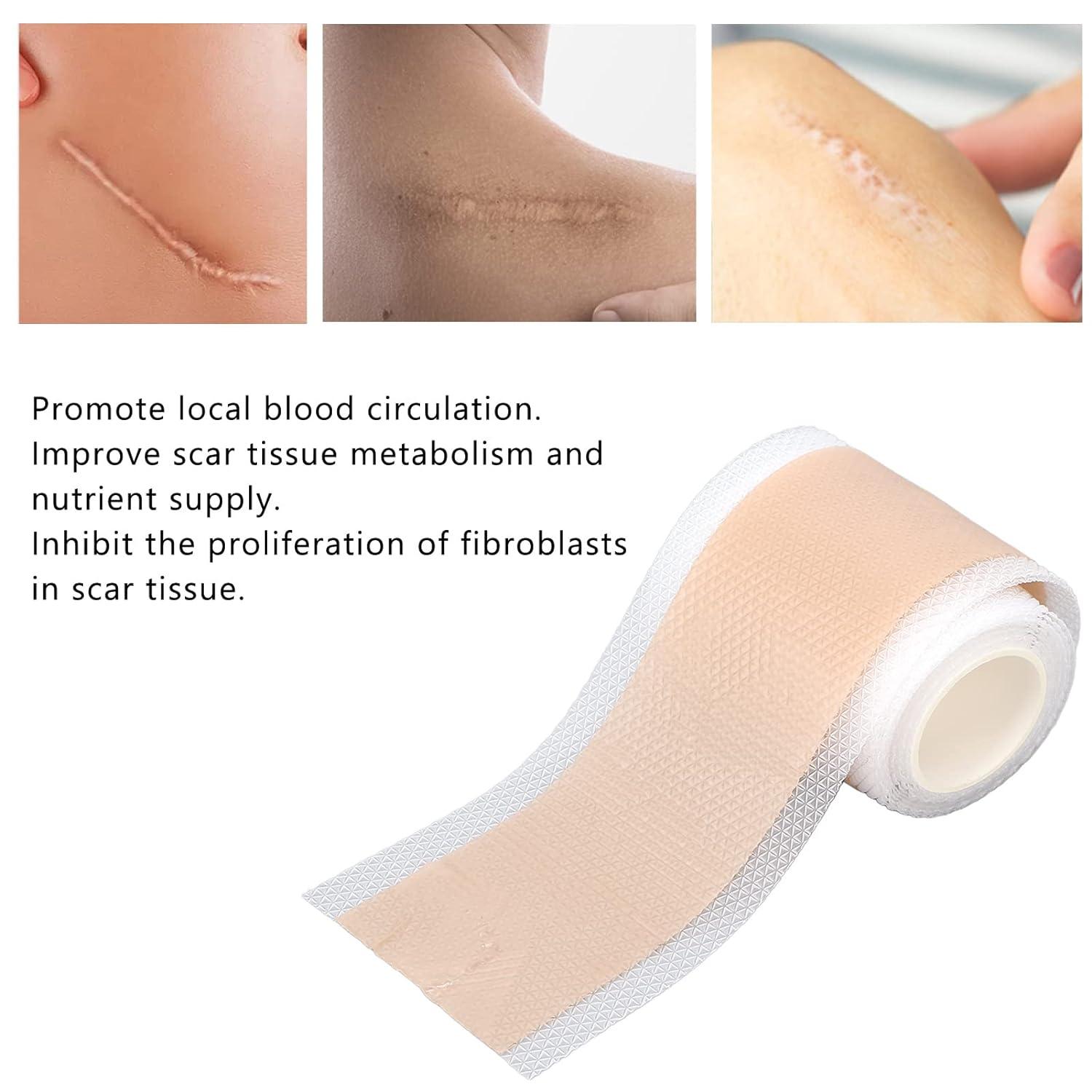 Scar Tape Roll for Hyperplasia Scar Removal SelfAdhesive & MetabolismBoosting Formula Burn