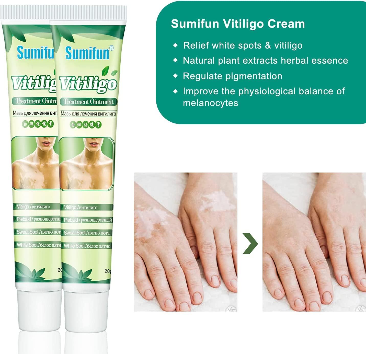 Sumifun Vitiligo Cream Skin Care for Vitiligo, Psoriasis