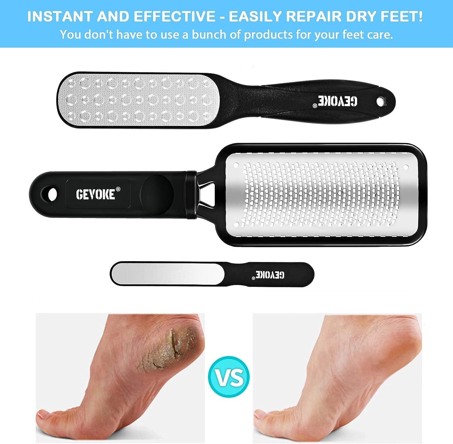 Foot File Foot Scrubber Pedicure, 2 Pcs Stainless Steel Callus Remover for  Feet, Professional Foot Grater Rasp Scraper Corns Callous Removers Tool to