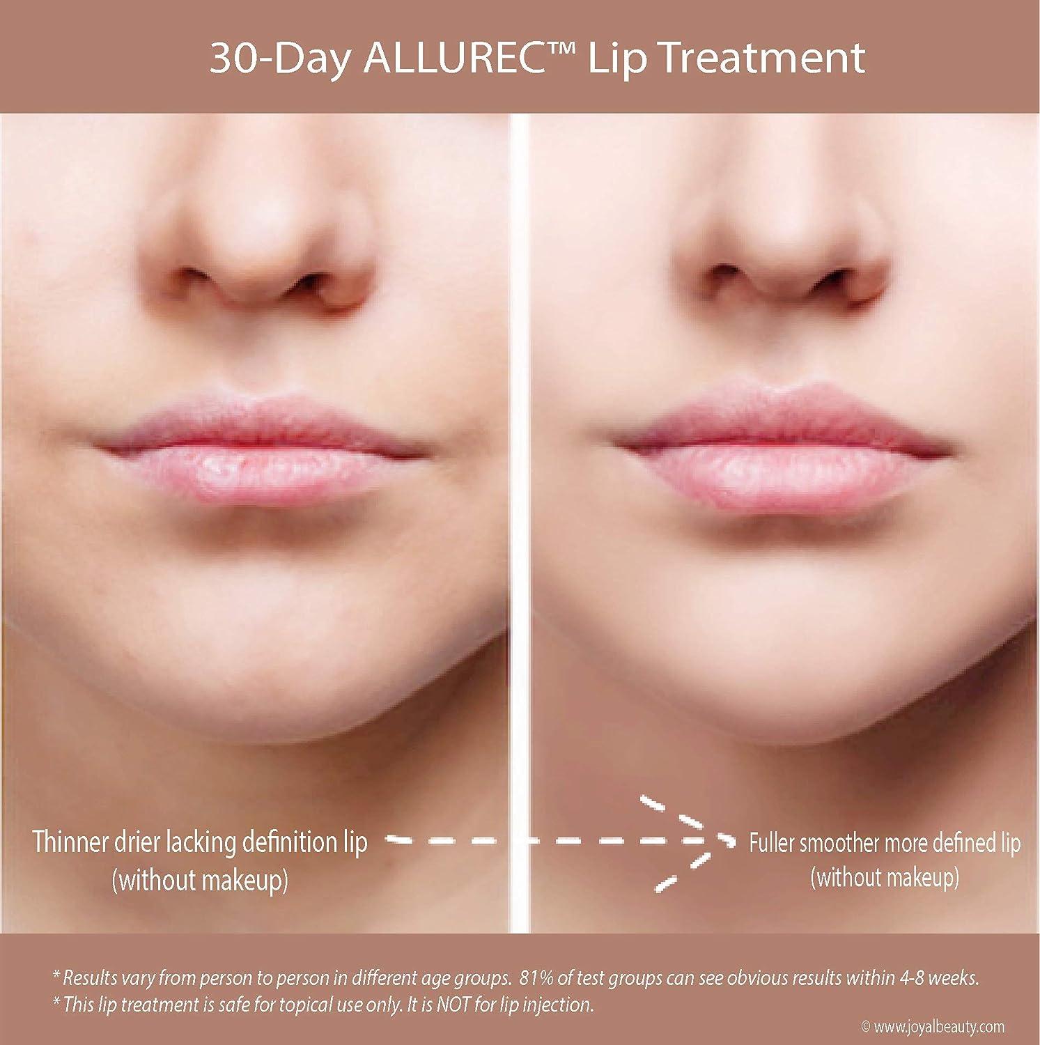 Lip treatment online for lines