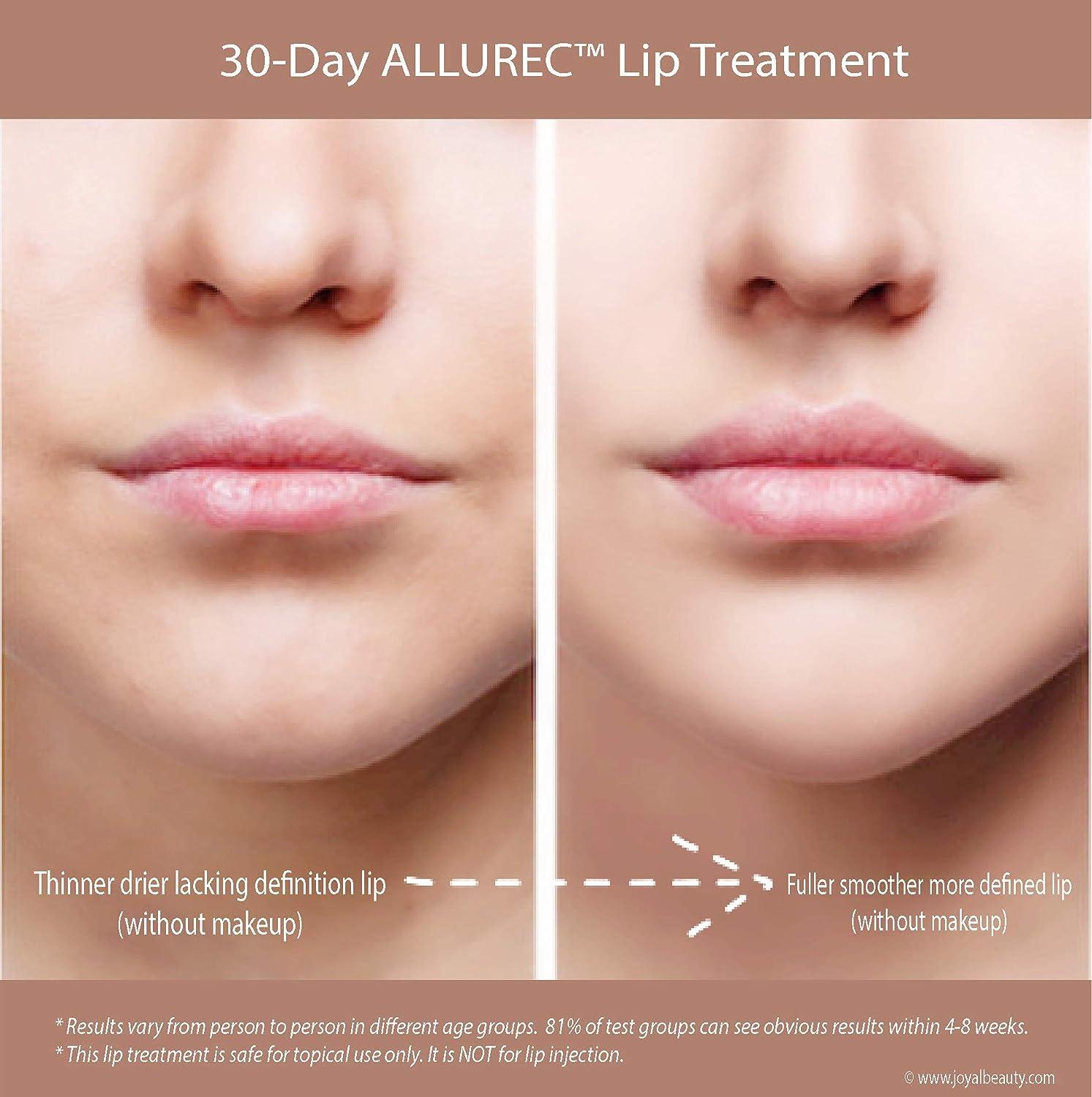 Smooth Lips: Singapore's Topical Treatments for Lip Wrinkles