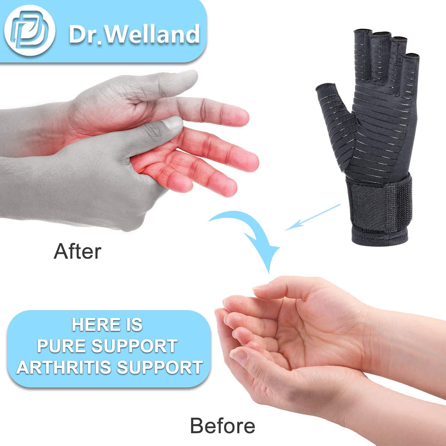 Dr. Welland Arthritis Gloves with Strap for Hand Pain Relief Open