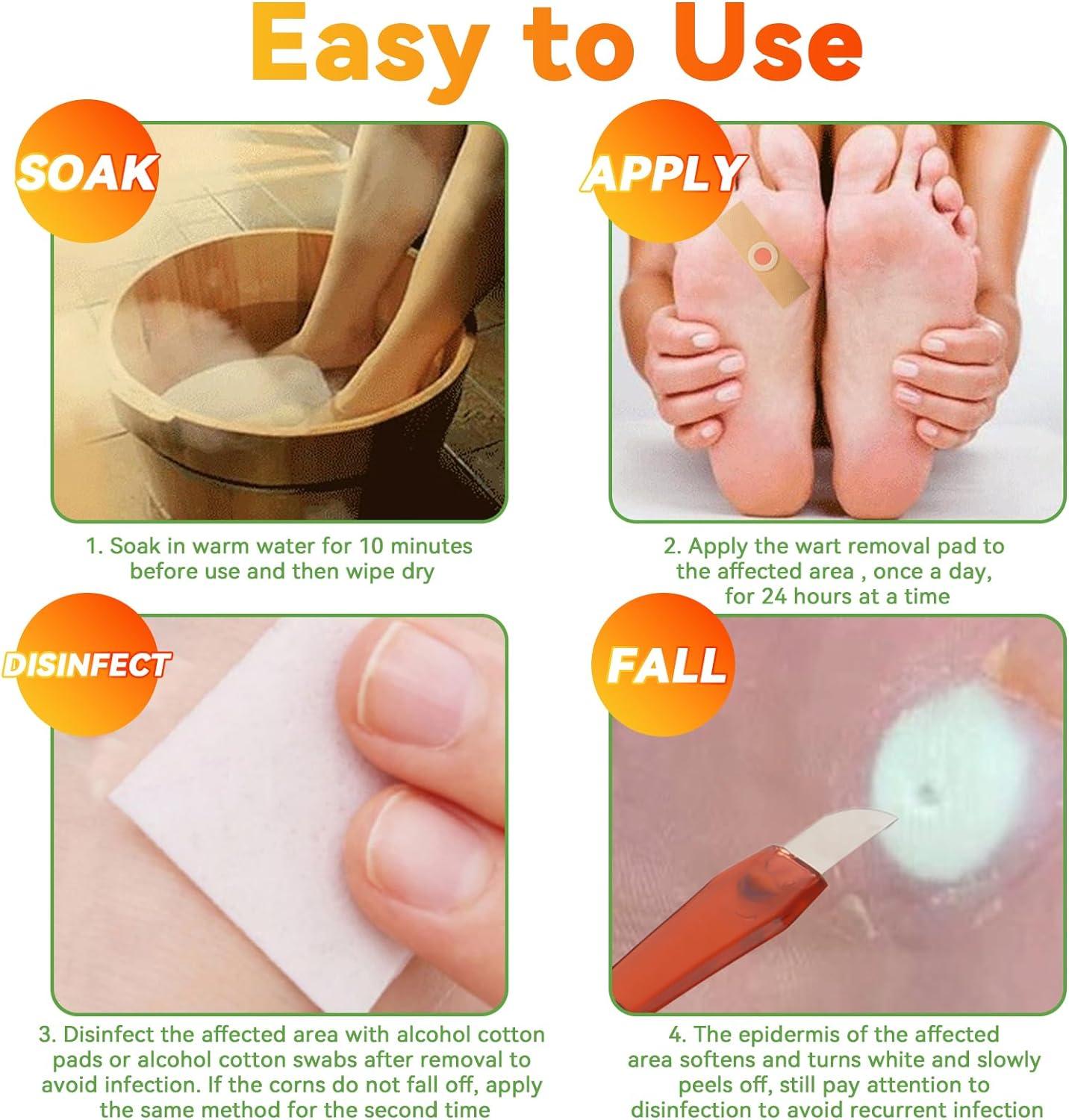 Folocone Wart Remover Pads 24 Pcs for Hands Feet, Corns - Main Image