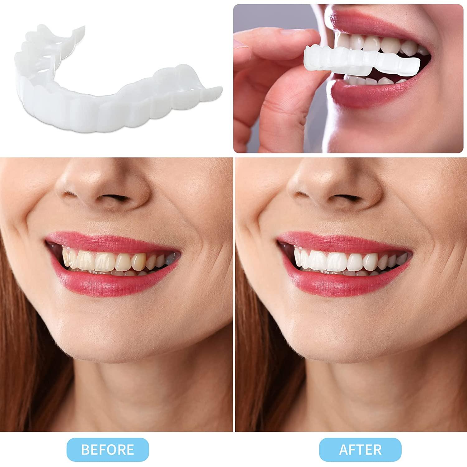 Instant Smile False Teeth 2 Pairs Veneers with Tweezers - Bright White