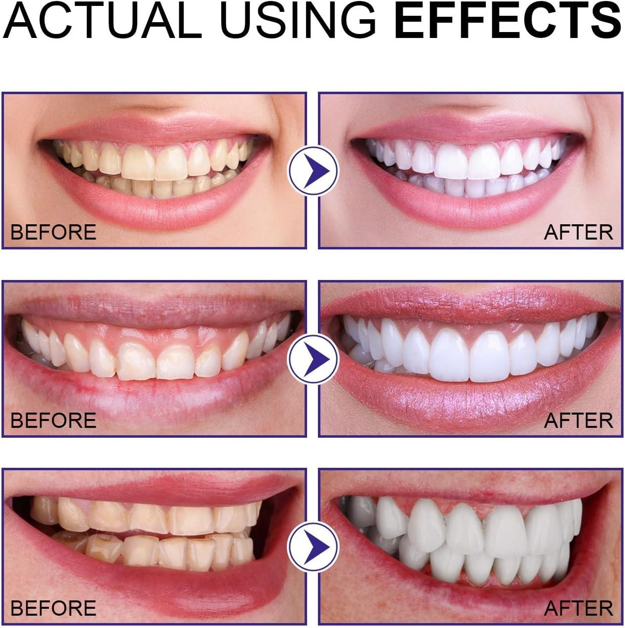 3 Days Tooth Elevator Powder & Stain Remover - Safe for Enamel Purple ...