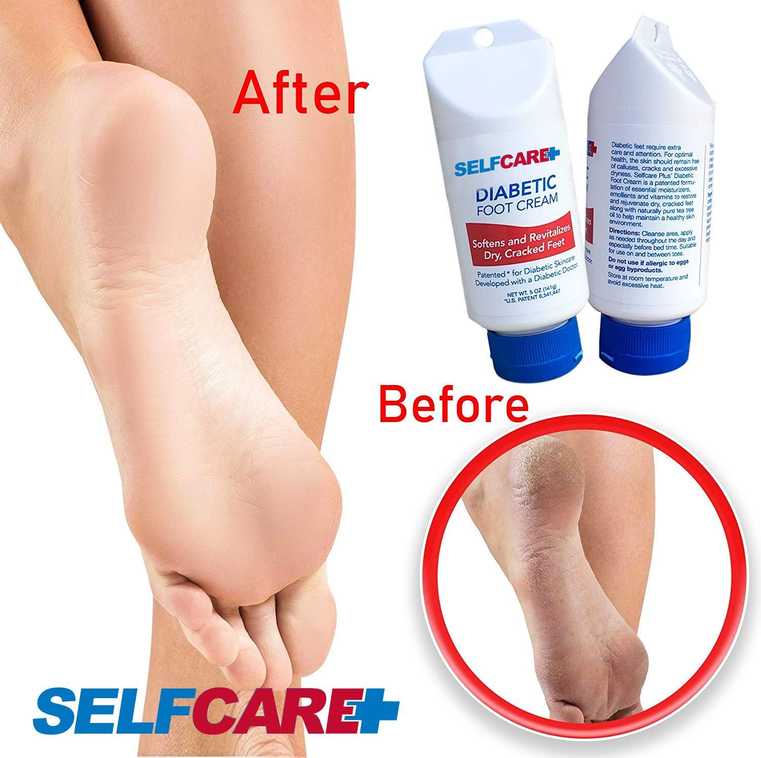 Selfcare Plus Diabetic Foot Cream For Dry Cracked Feet. Leaves Hands