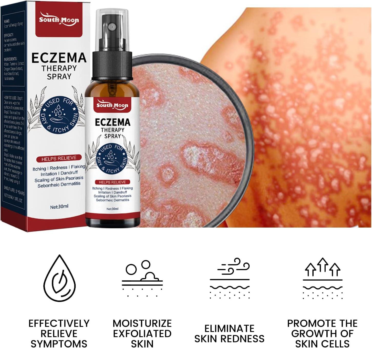 Natural Eczema Therapy Spray Soothing Relief for Dry, Itchy Skin (5pcs)