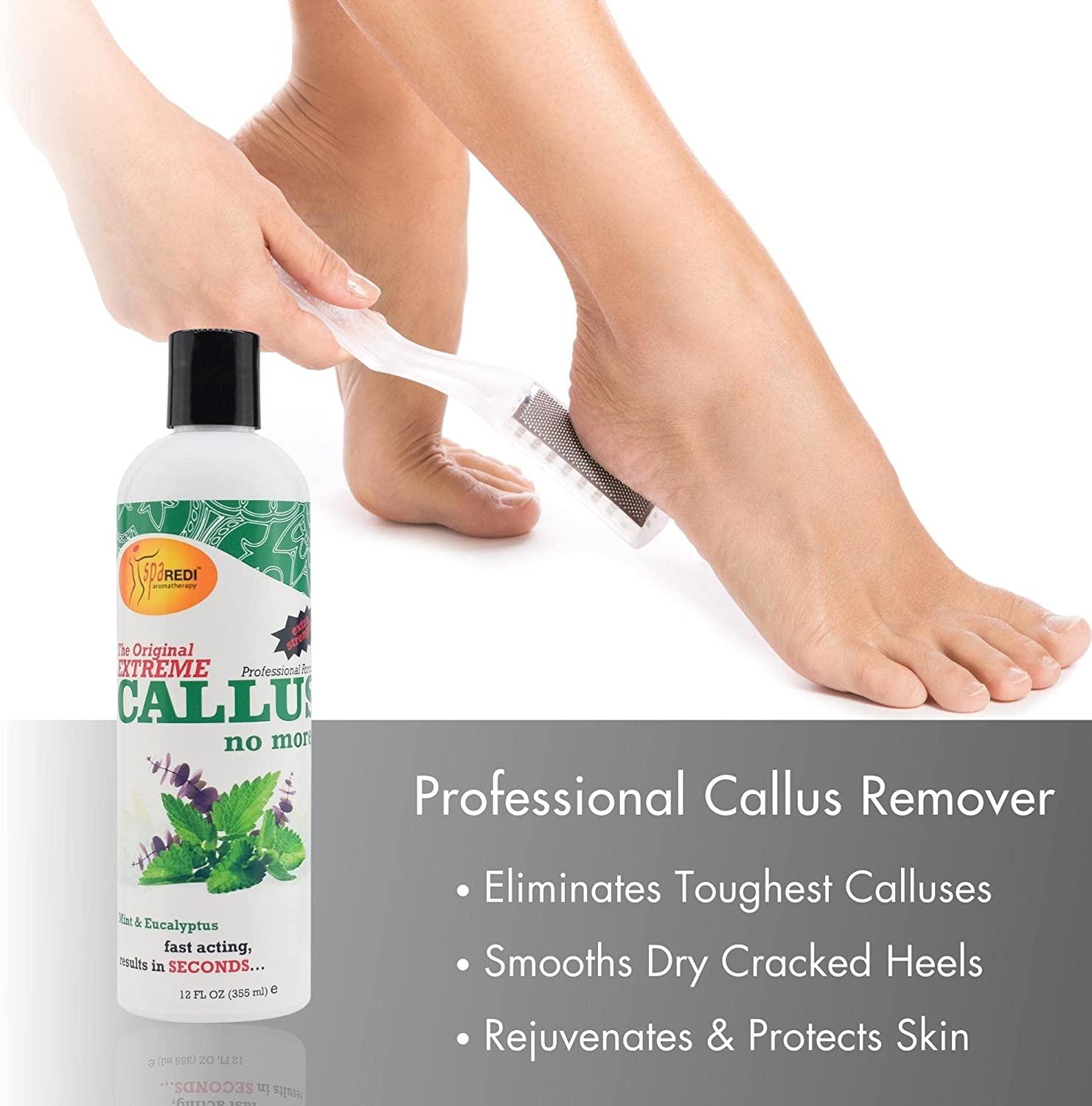SPA REDI Callus Remover for Feet Gel, Mint and Eucalyptus, 12 Oz