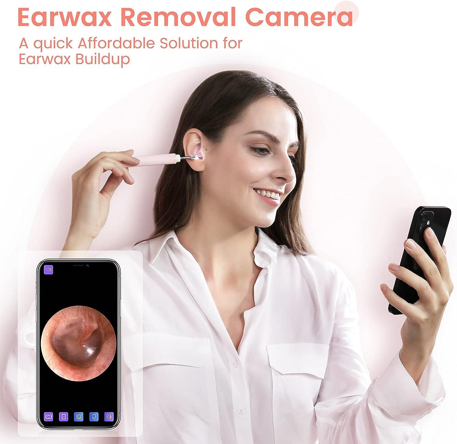 Wifi Otoscope Ear Cleaning Kit, Earwax removal tool – ScopeAround