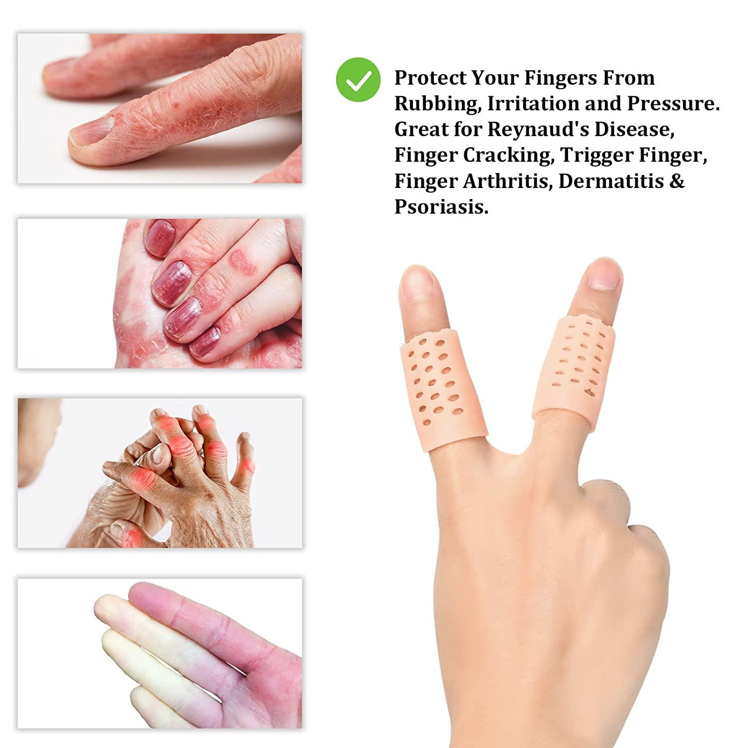 Gel Finger Cots (Breathable, Latex Free), Finger Protectors with Hole