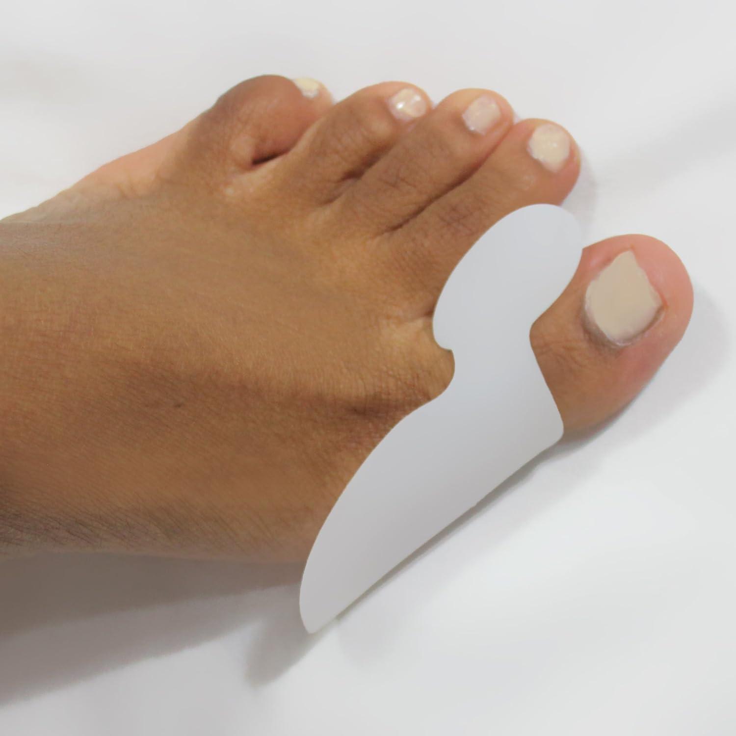 Cosa mettere su alluce valgo infiammato: Come alleviare il dolore