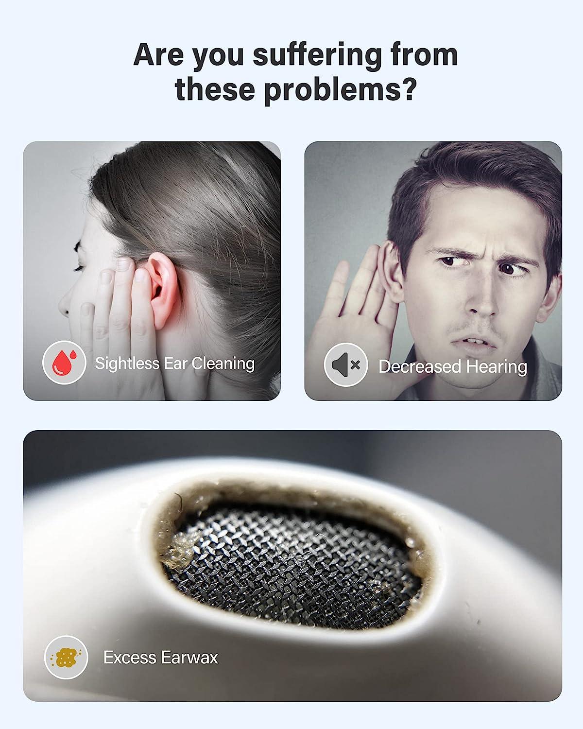 Ear Wax Removal Ear Cleaner with 1080P Ear Scope Camera & 6 LED Light