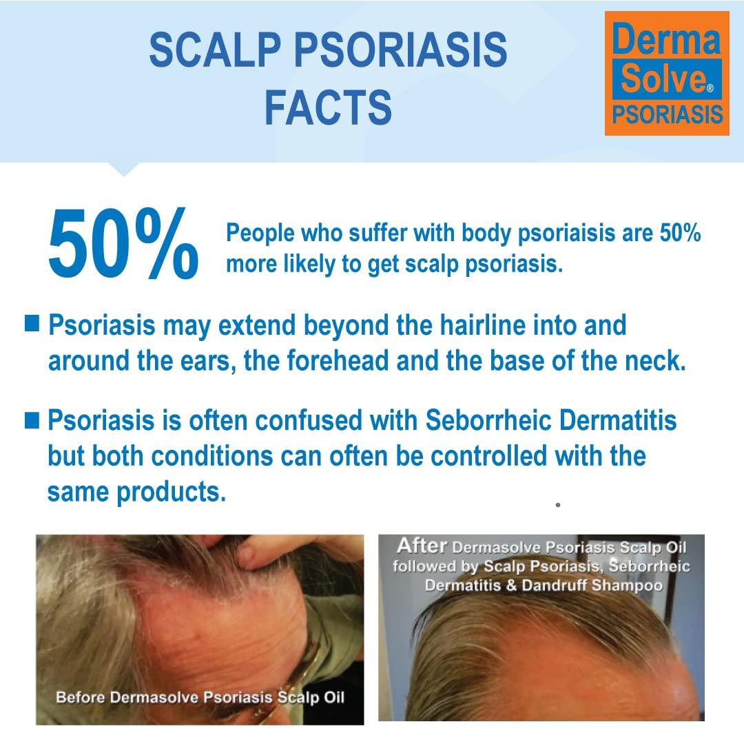 Dermasolve Psoriasis Scalp Oil (2Pack) Seborrheic Dermatitis