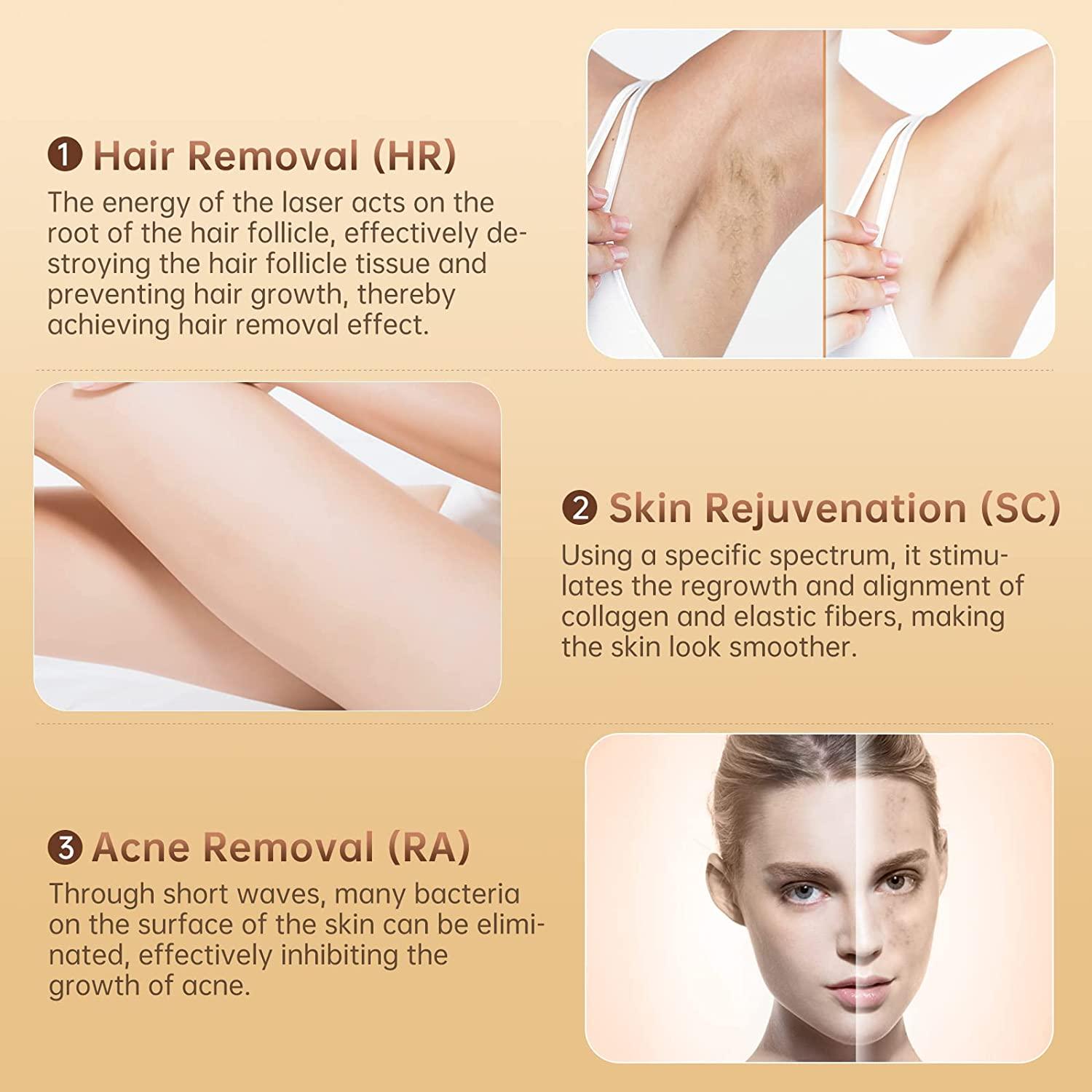 Laser Hair Removal for Women and Men, Upgraded 999,900+ Flashes Permanent  Painless At-Home Hair Removal Device for Armpits,Legs and Whole Body Use