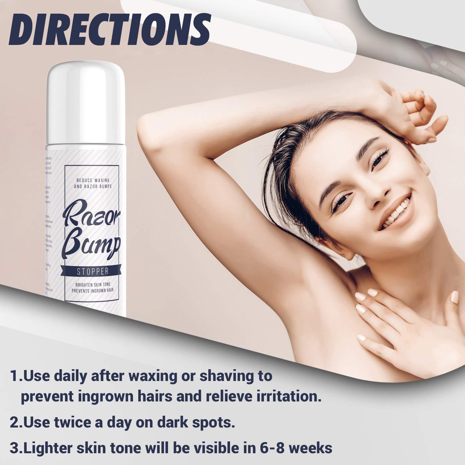 Roll On Razor Bump Treatment for Bikini Area, Legs, Underarms, Groin