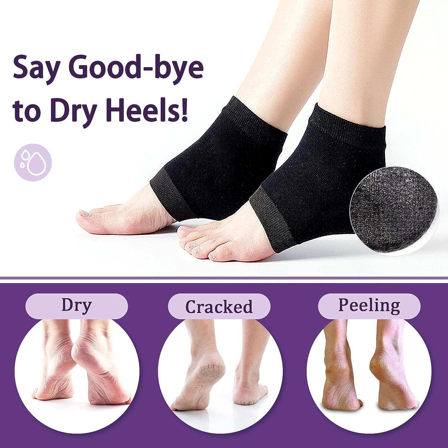 Rishaca Moisturizing Gel Socks Repair Cracked Heels Treatment, Dry Foot  Skin Open Toe Silicone Sock for Spa, Day Night Care for Women (10  Pair/Black) : Amazon.in: Health & Personal Care