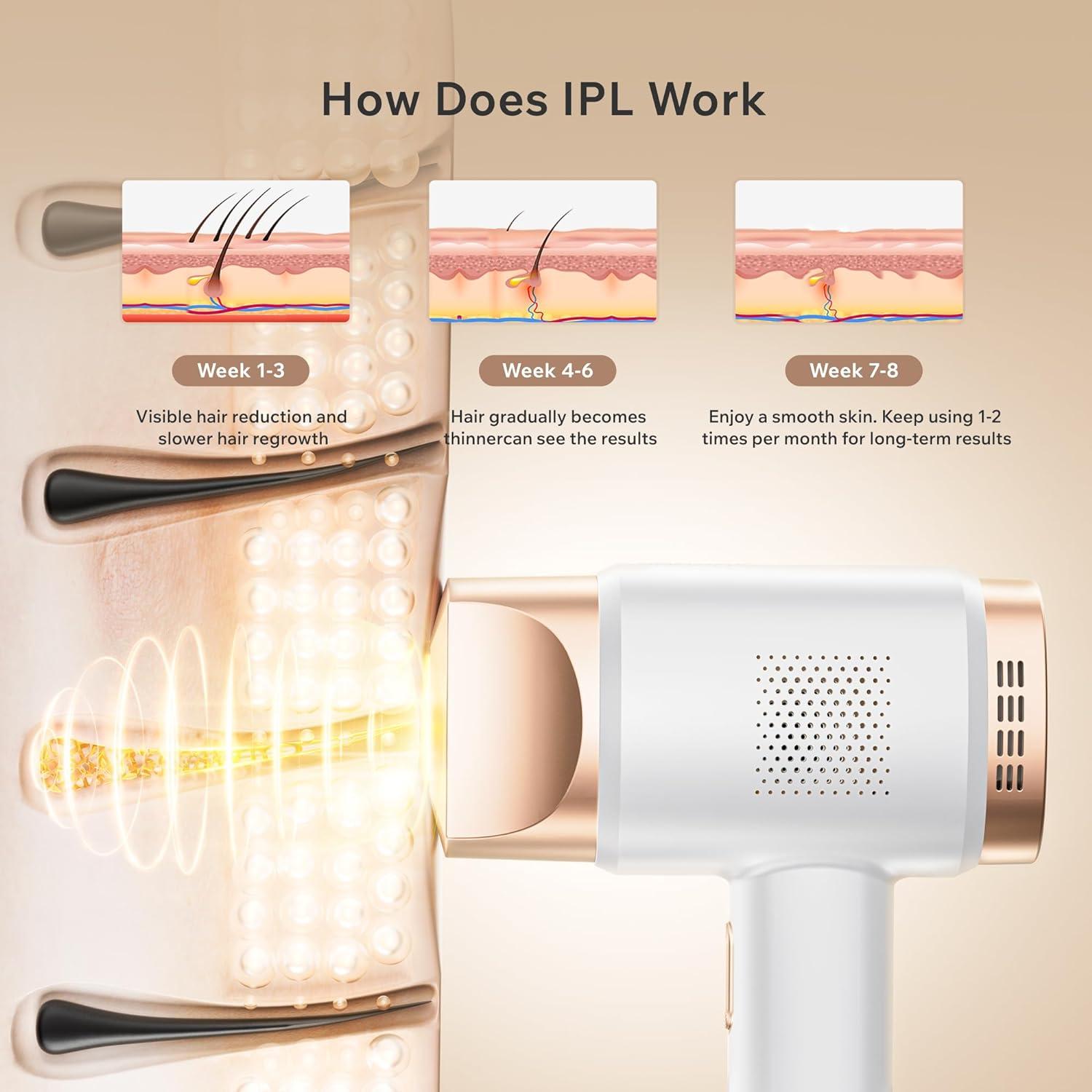 Aminzer hair removal clearance