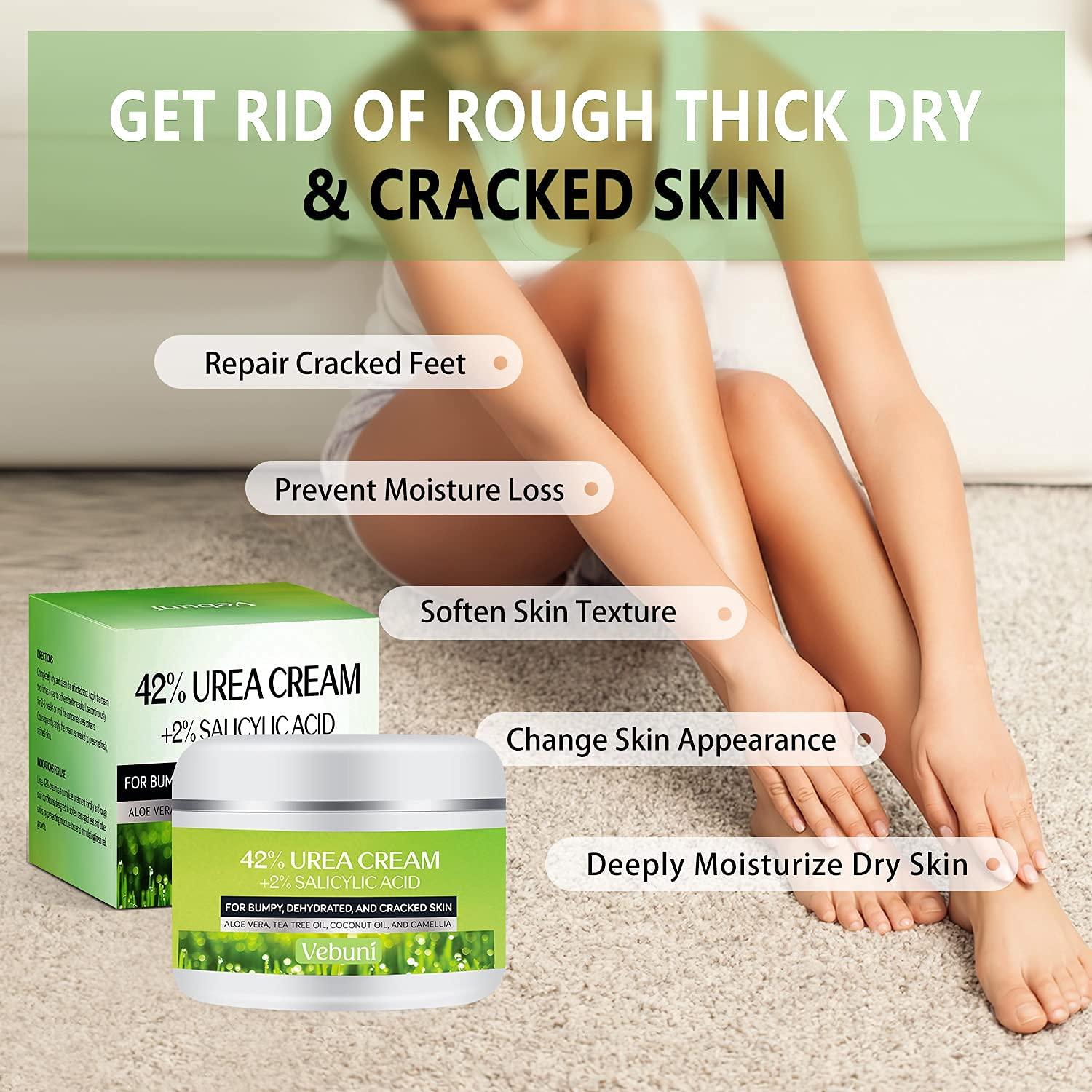 Urea Cream 42 Foot Cream Salicylic Acid 4 Oz Upgraded Callus Remover