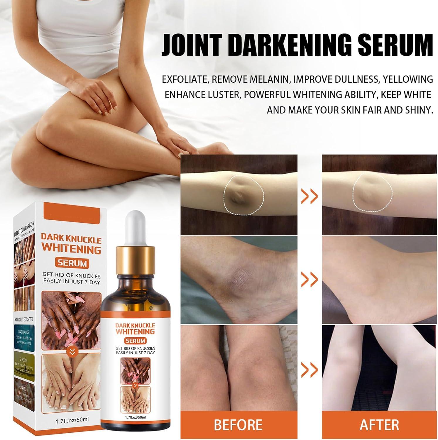 Dark Knuckles Remover From Hand Dark Spot Correcting Glow Serum