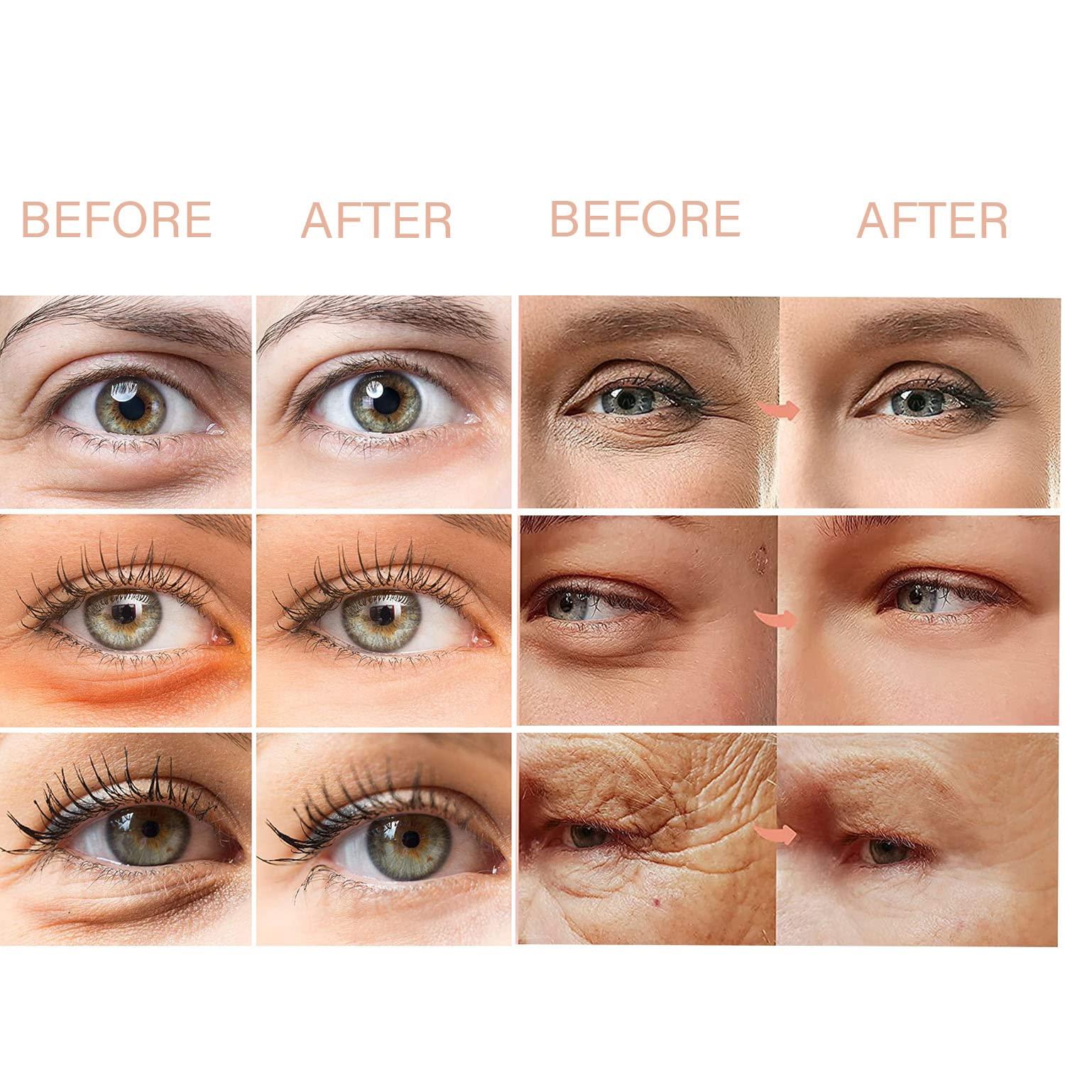 Mens Eye Cream,eye Bag Treatment For Anti Aging,reduce Dark Circles, Puffy  Undereye Bags, Crows Feet, & Fine Lines 7ml | Fruugo BH