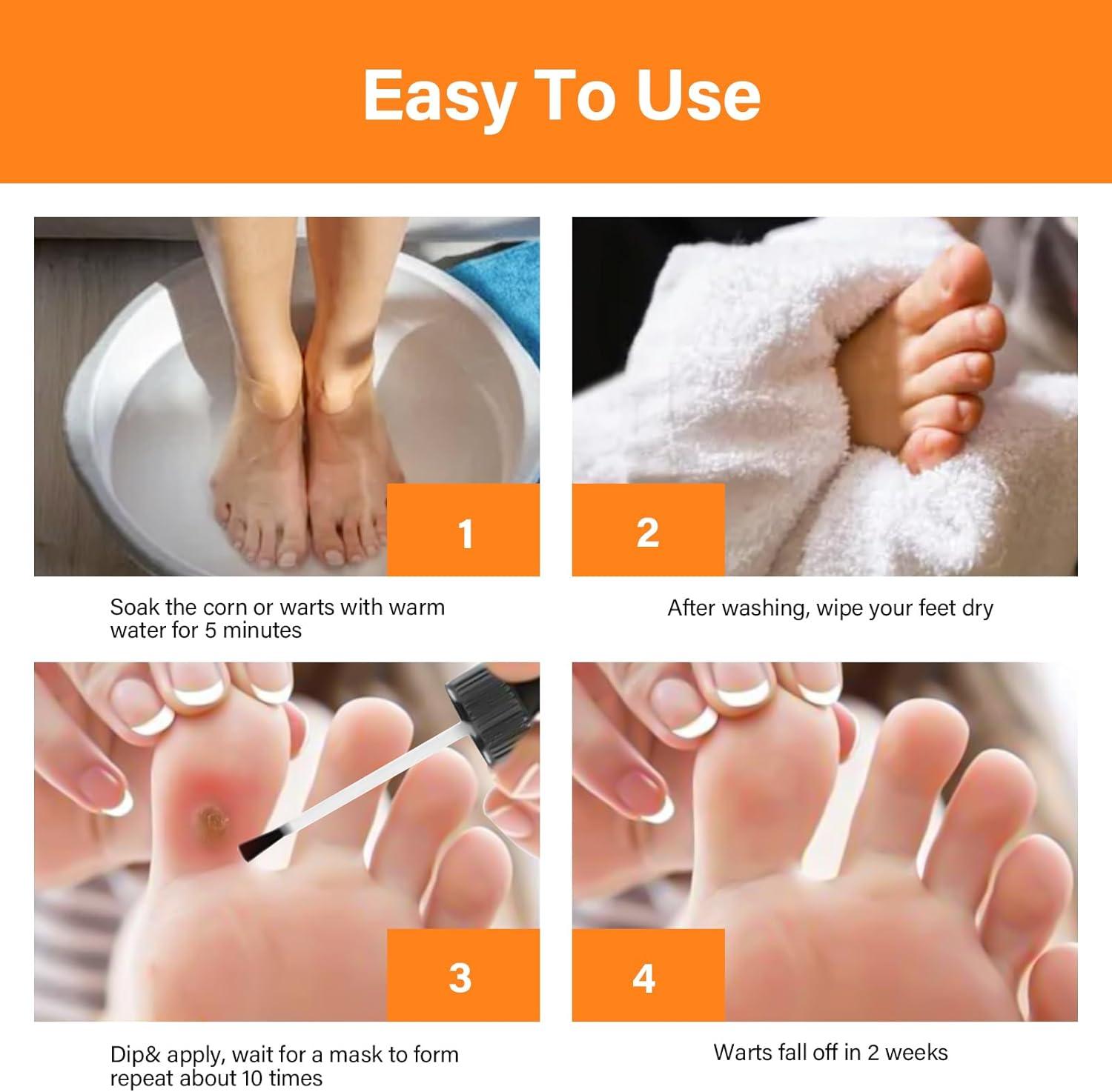 Corn Removers for Feet Extra Strength Foot Corn Remover Liquid Corn