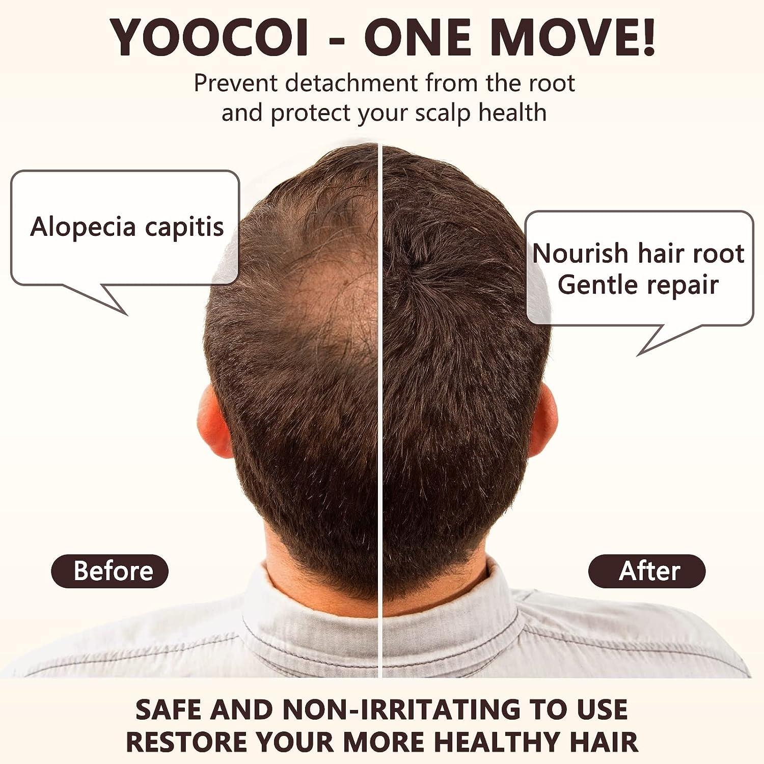 Men's Hair Growth Serum with Biotin 5% Minoxidil - 2.0 oz