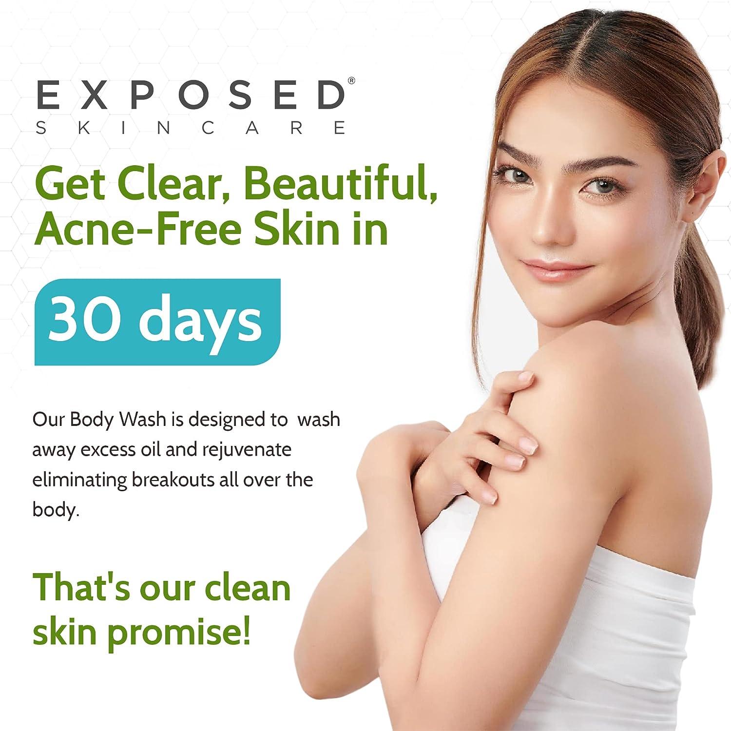 Exposed Skin Care Back and Body Acne Wash Exfoliating Wash to Clean and