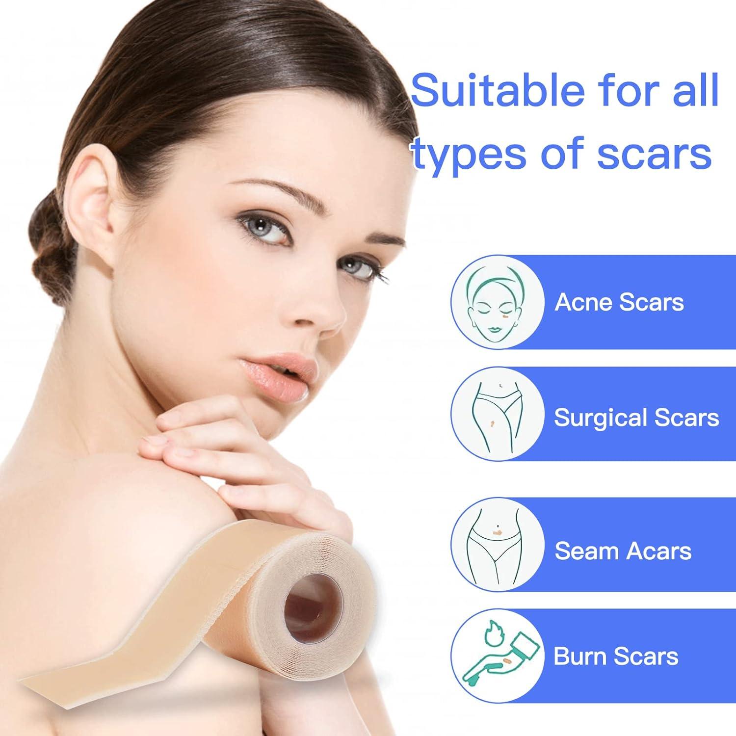 Silicone Scar Sheets 6 Pack For Csection Scar Treatment Surgery Burn