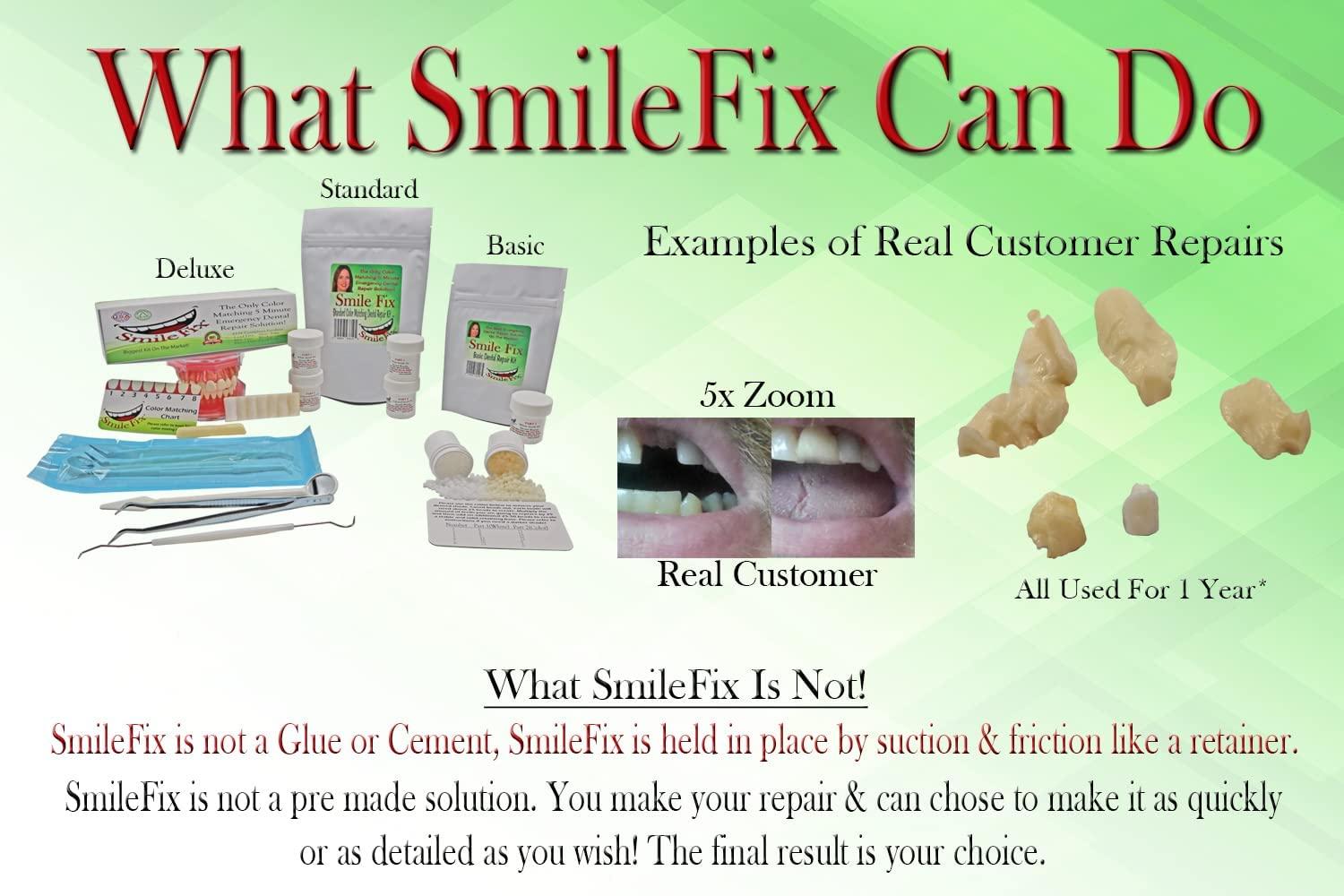 SmileFix Basic Dental Repair Kit Missing or broken tooth. Gaps