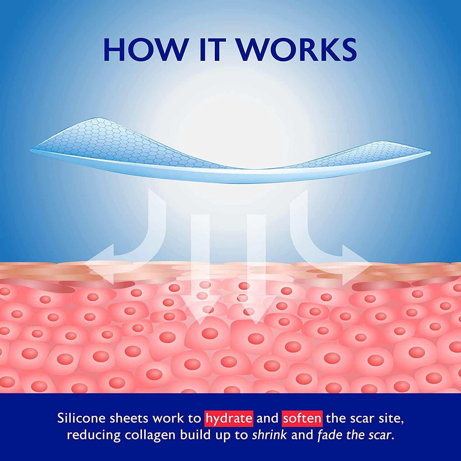 Beautivity Advanced Scar Removal Silicone Tape for Hypertrophic Scars