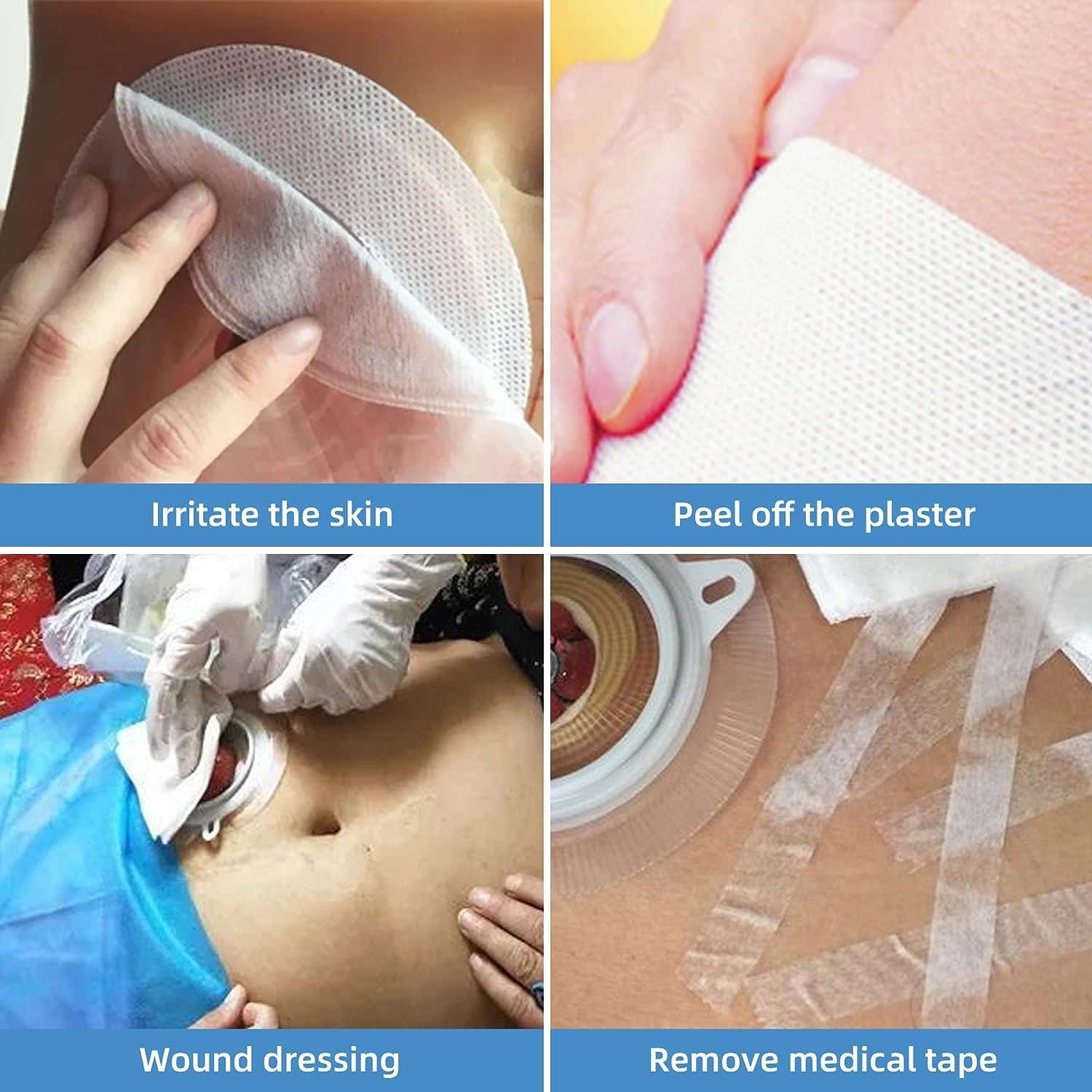 Adapt Skin Stoma Powder 1 Oz Hypochlorous Acid Wound Therapy for